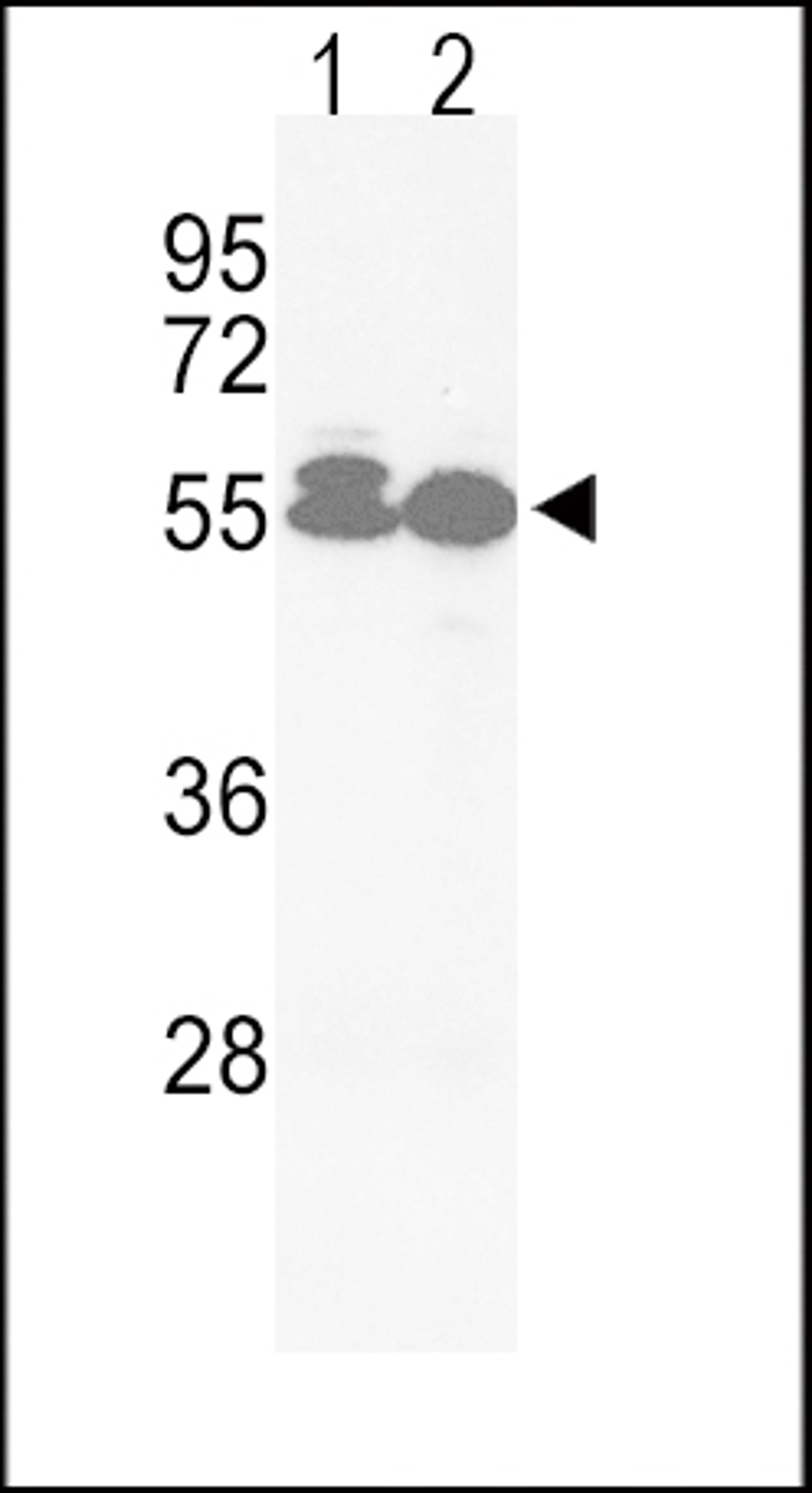 Western blot analysis of hACVRL1-L489 in Jurkat(lane 1), HepG2(lane 2) cell line lysates (35ug/lane)