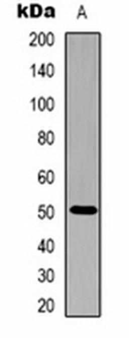 Western blot analysis of purified alliinase (Lane 1) whole cell lysates using Alliinase antibody