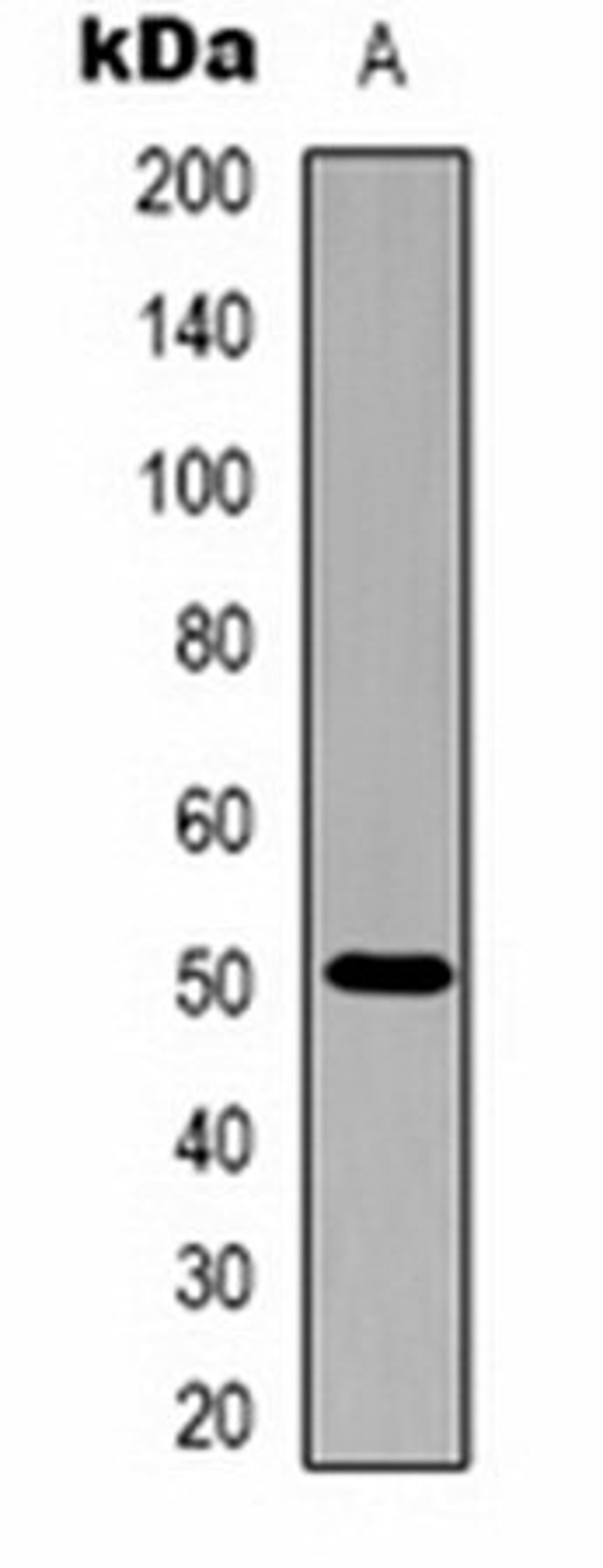 Western blot analysis of purified alliinase (Lane 1) whole cell lysates using Alliinase antibody