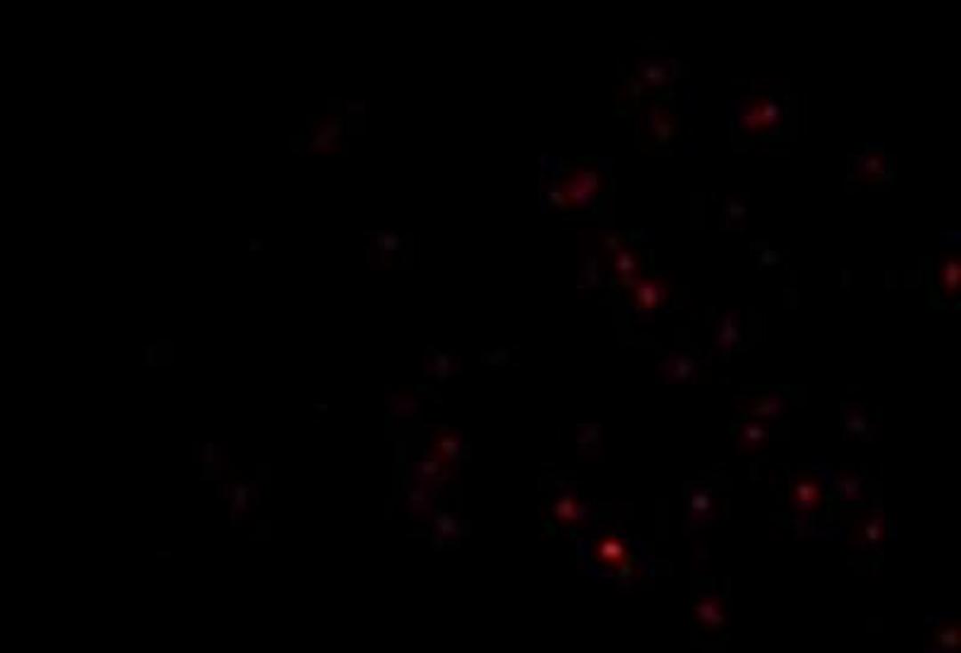 Immunofluorescence: TEP1 Antibody [NBP1-77285] - Human Lung cells.