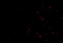 Immunofluorescence: TEP1 Antibody [NBP1-77285] - Human Lung cells.