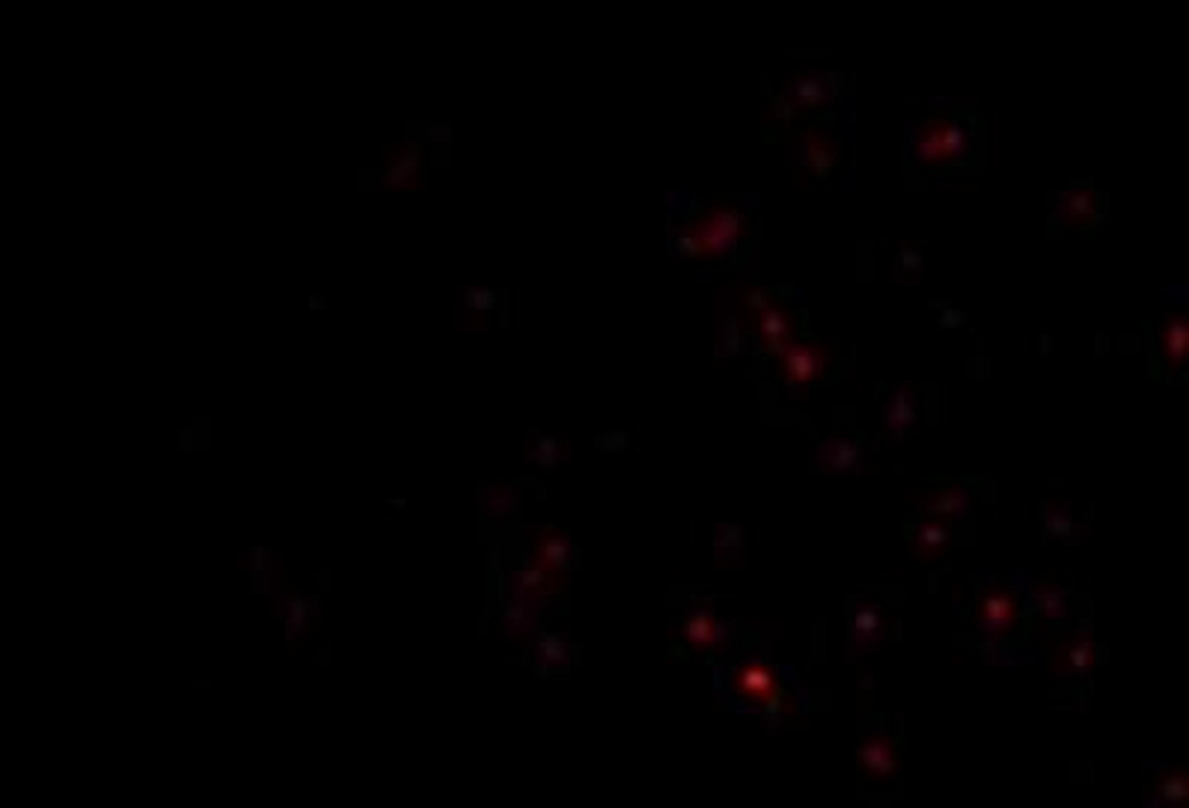 Immunofluorescence: TEP1 Antibody [NBP1-77285] - Human Lung cells.