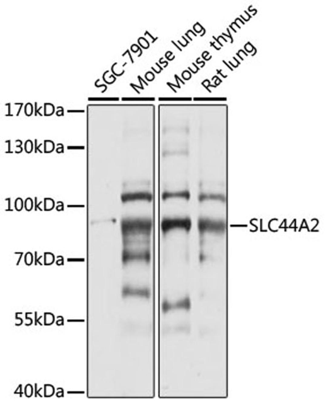 Western blot - SLC44A2 antibody (A15178)