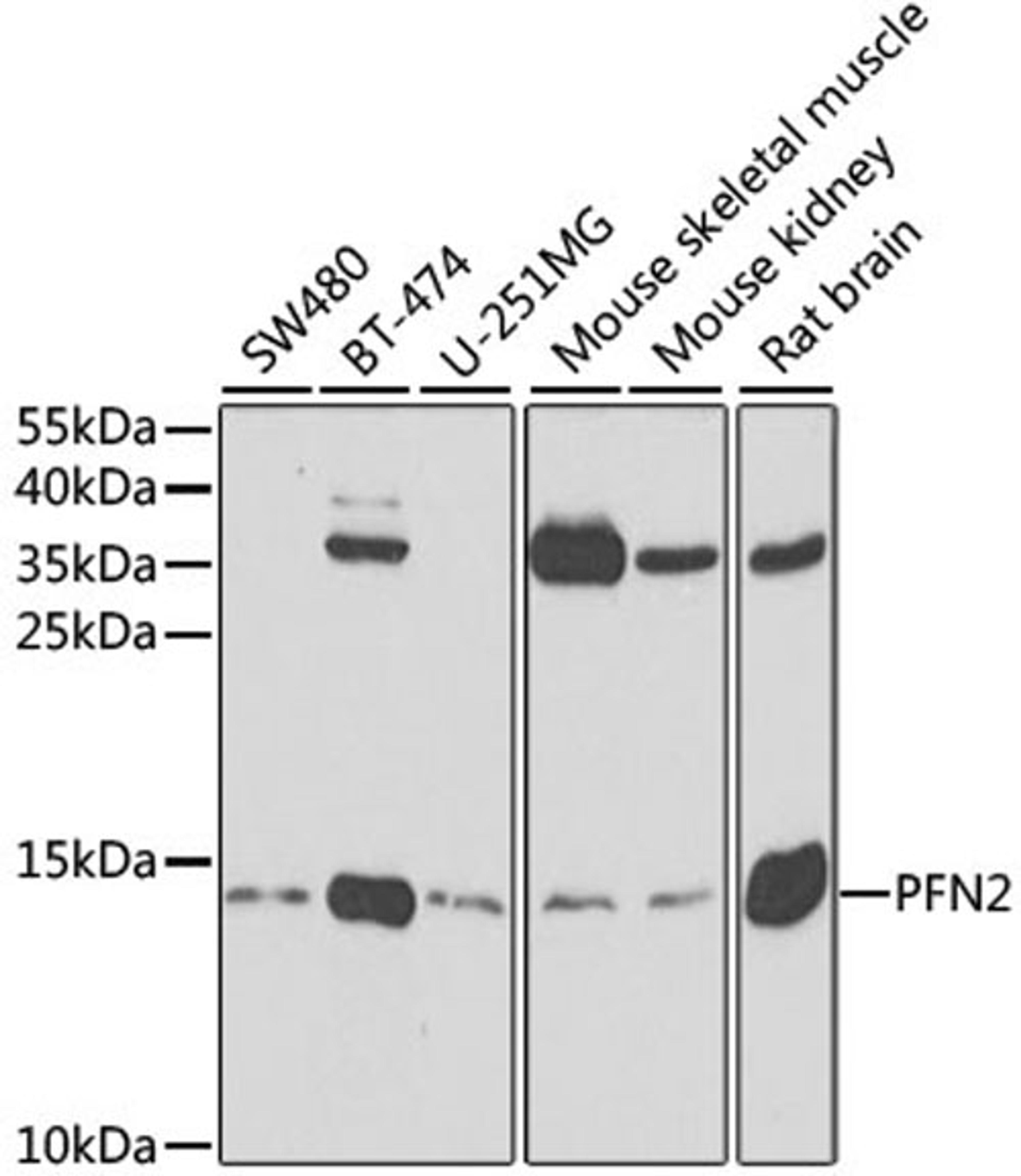Western blot - PFN2 antibody (A3074)