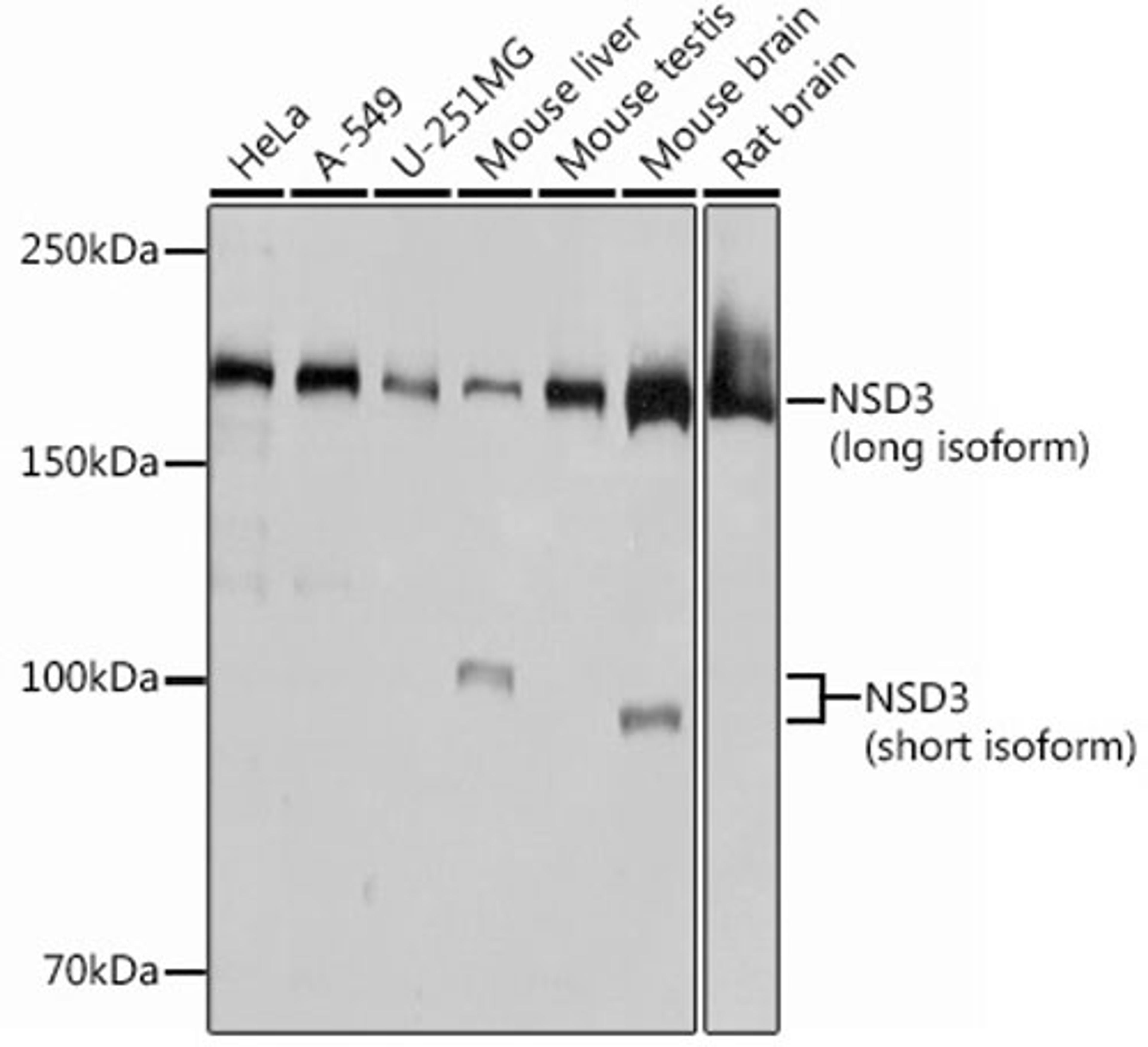 Western blot - NSD3 Rabbit mAb (A12342)