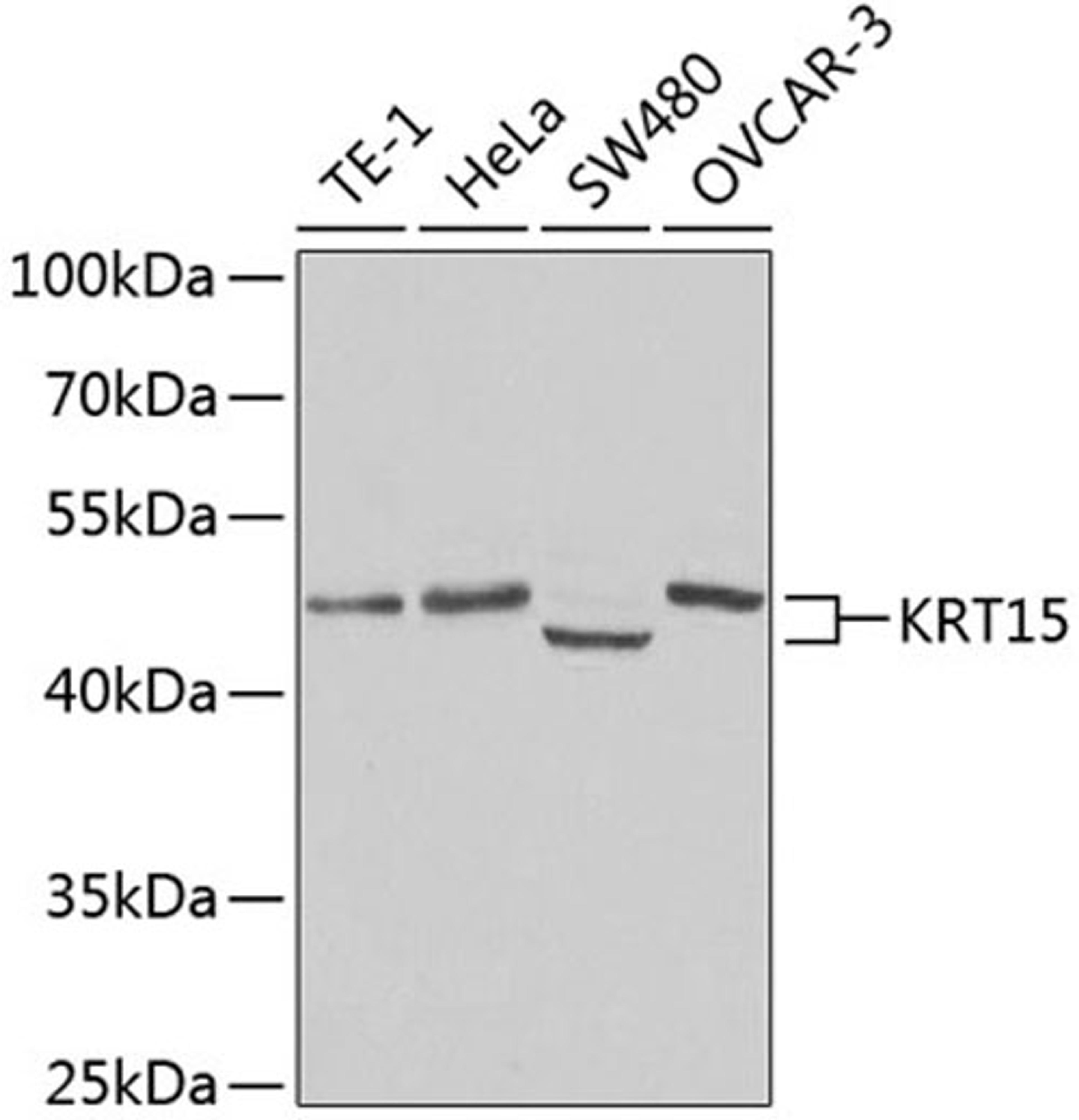 Western blot - KRT15 antibody (A2660)