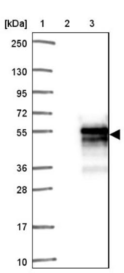 Western Blot: SAP30BP Antibody [NBP2-38685] - Lane 1: Marker [kDa] 250, 130, 95, 72, 55, 36, 28, 17, 10<br/>Lane 2: Negative Control<br/>Lane 3: LY415705