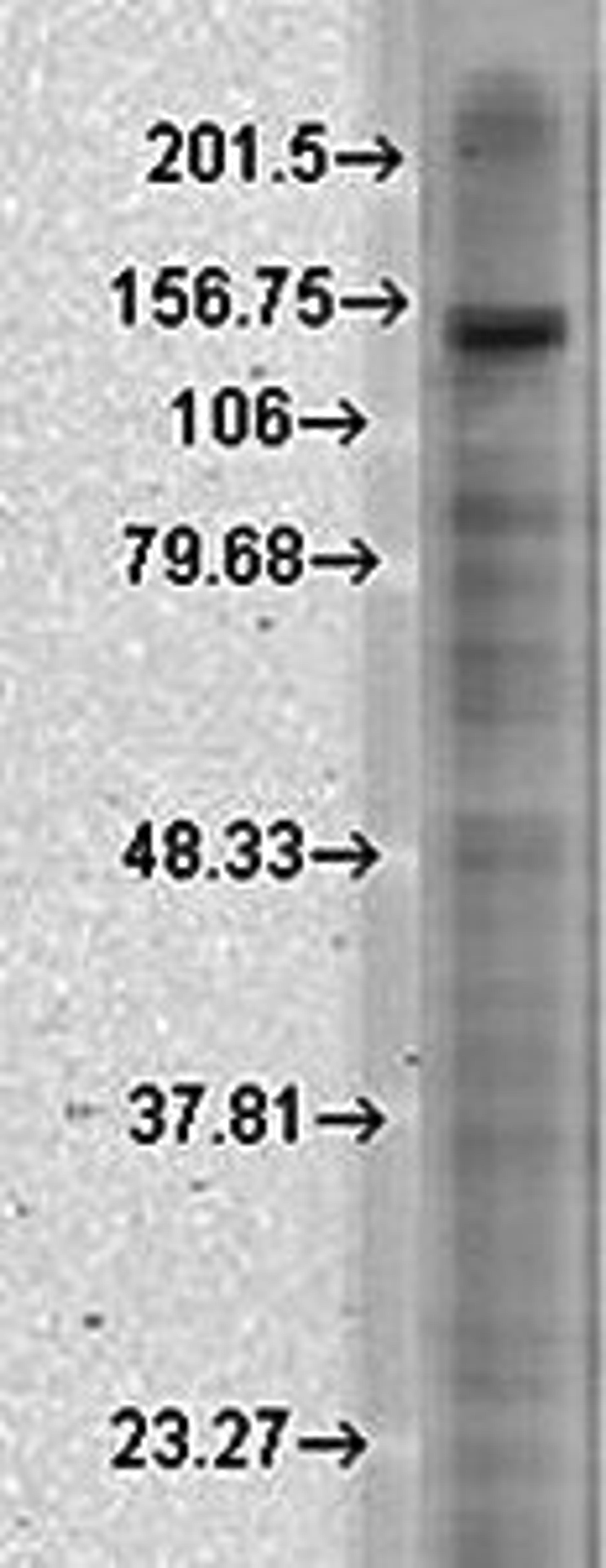 Western blot analysis of rat brain membrane lysates using Slo2.1 antibody