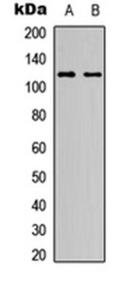 Western blot analysis of HeLa (Lane1), NIH3T3 (Lane2) whole cell using NOTCH1 antibody