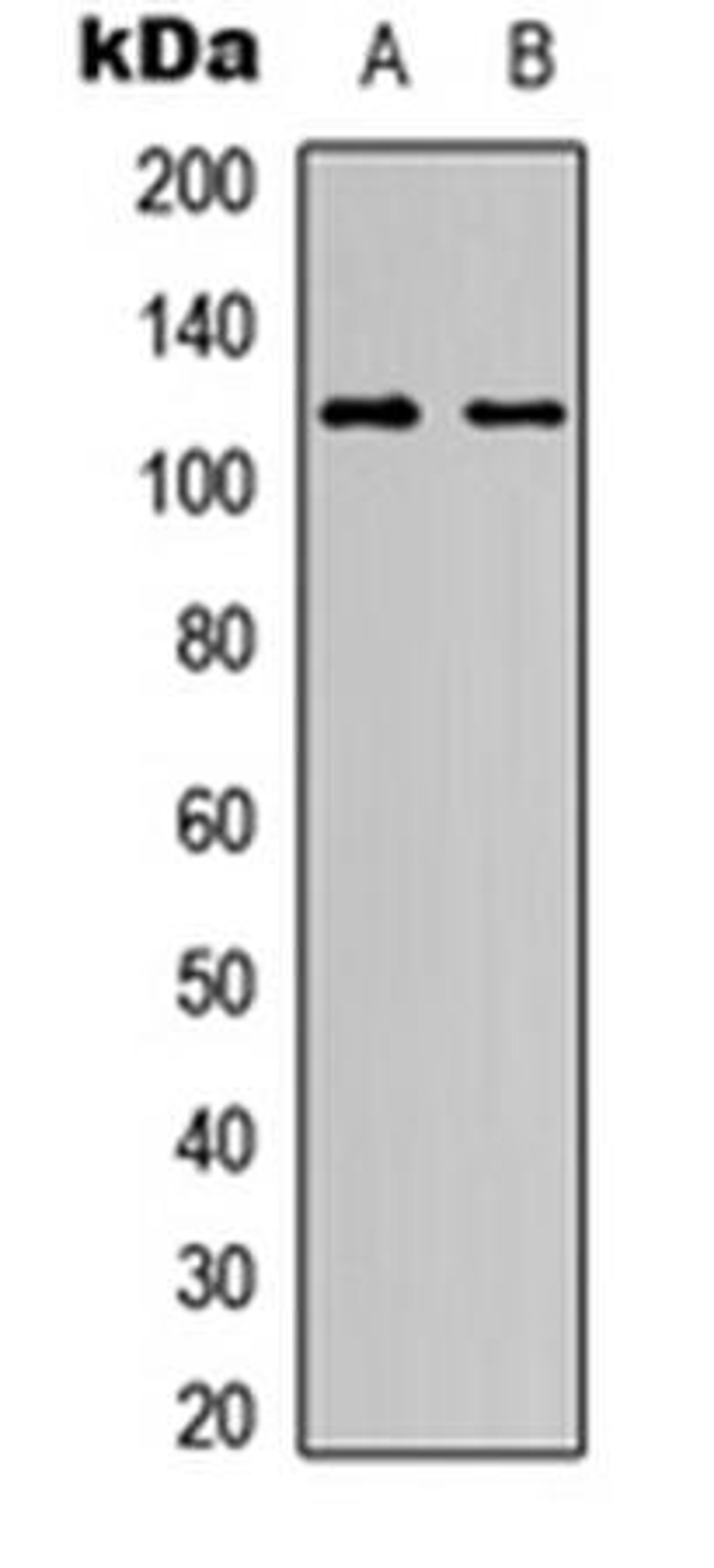 Western blot analysis of HeLa (Lane1), NIH3T3 (Lane2) whole cell using NOTCH1 antibody