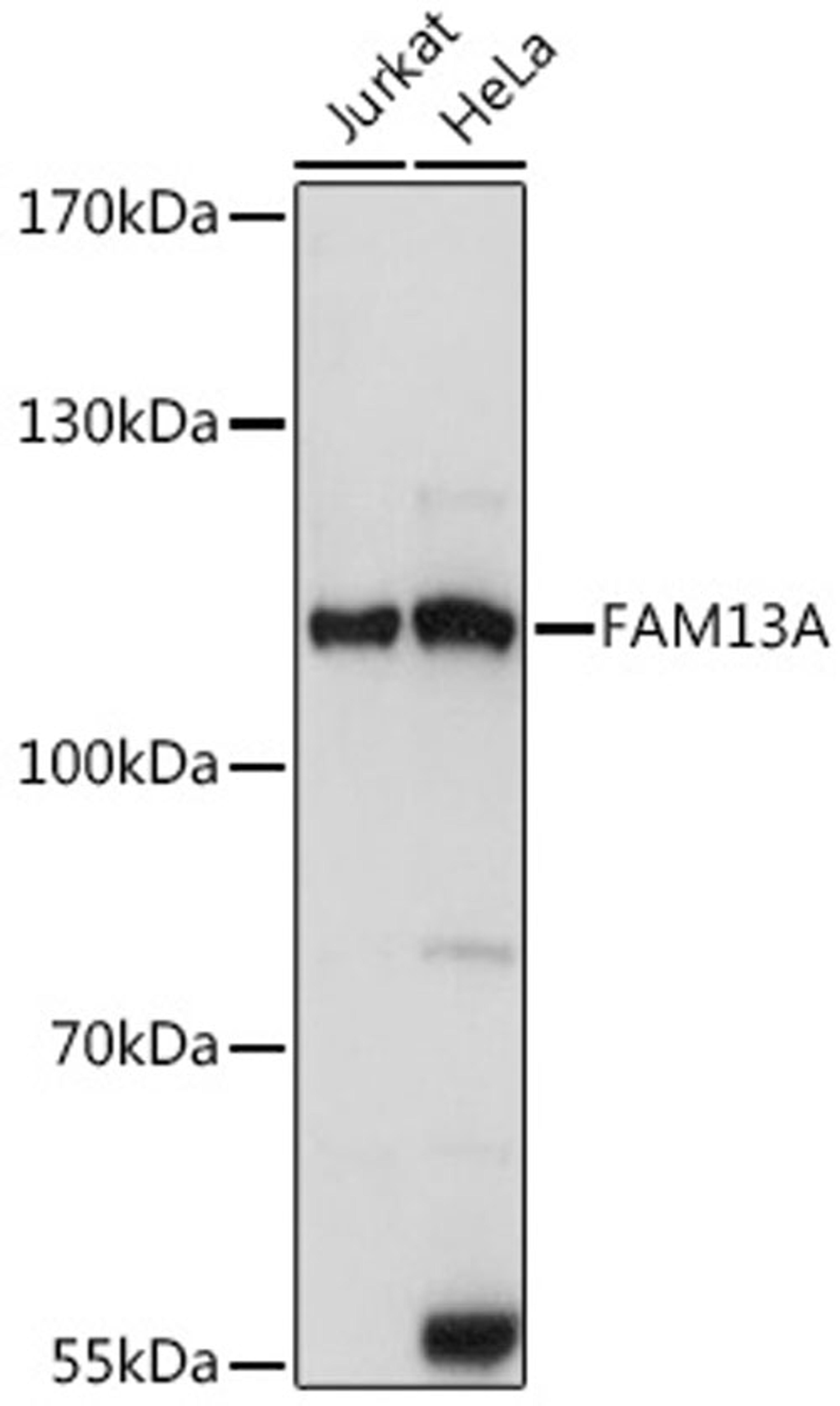 Western blot - FAM13A antibody (A14576)