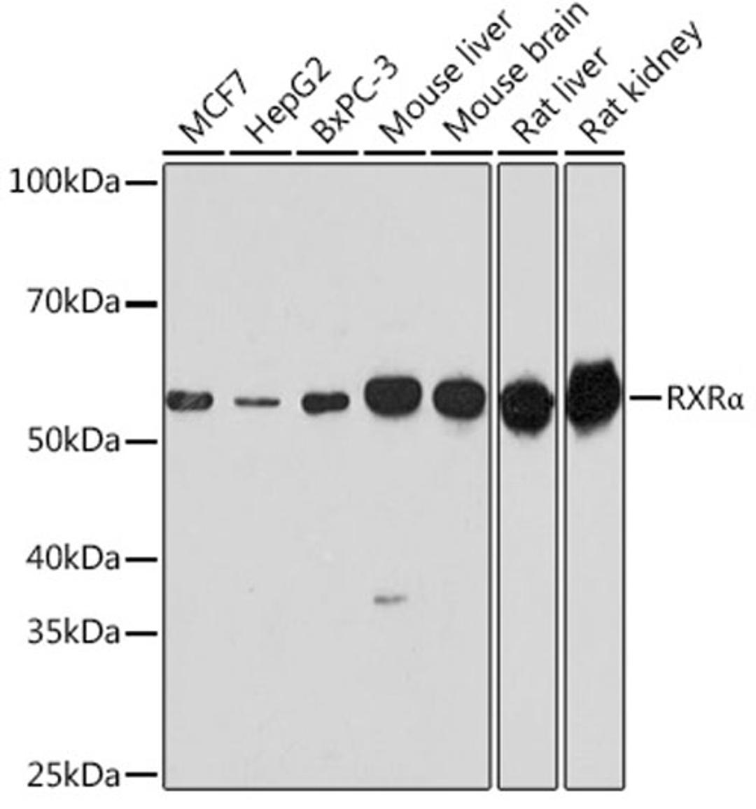 Western blot - RXRa antibody (A15242)