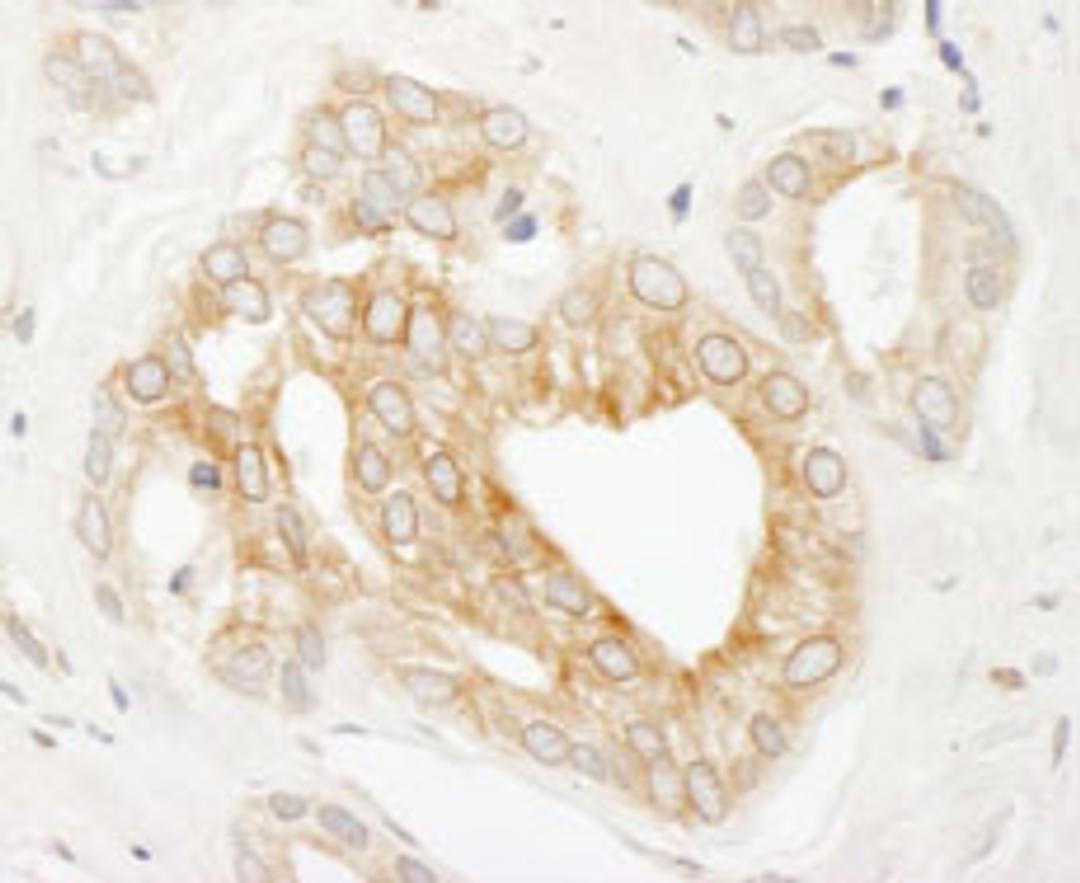 Detection of human p600 by immunohistochemistry.