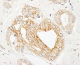 Detection of human p600 by immunohistochemistry.