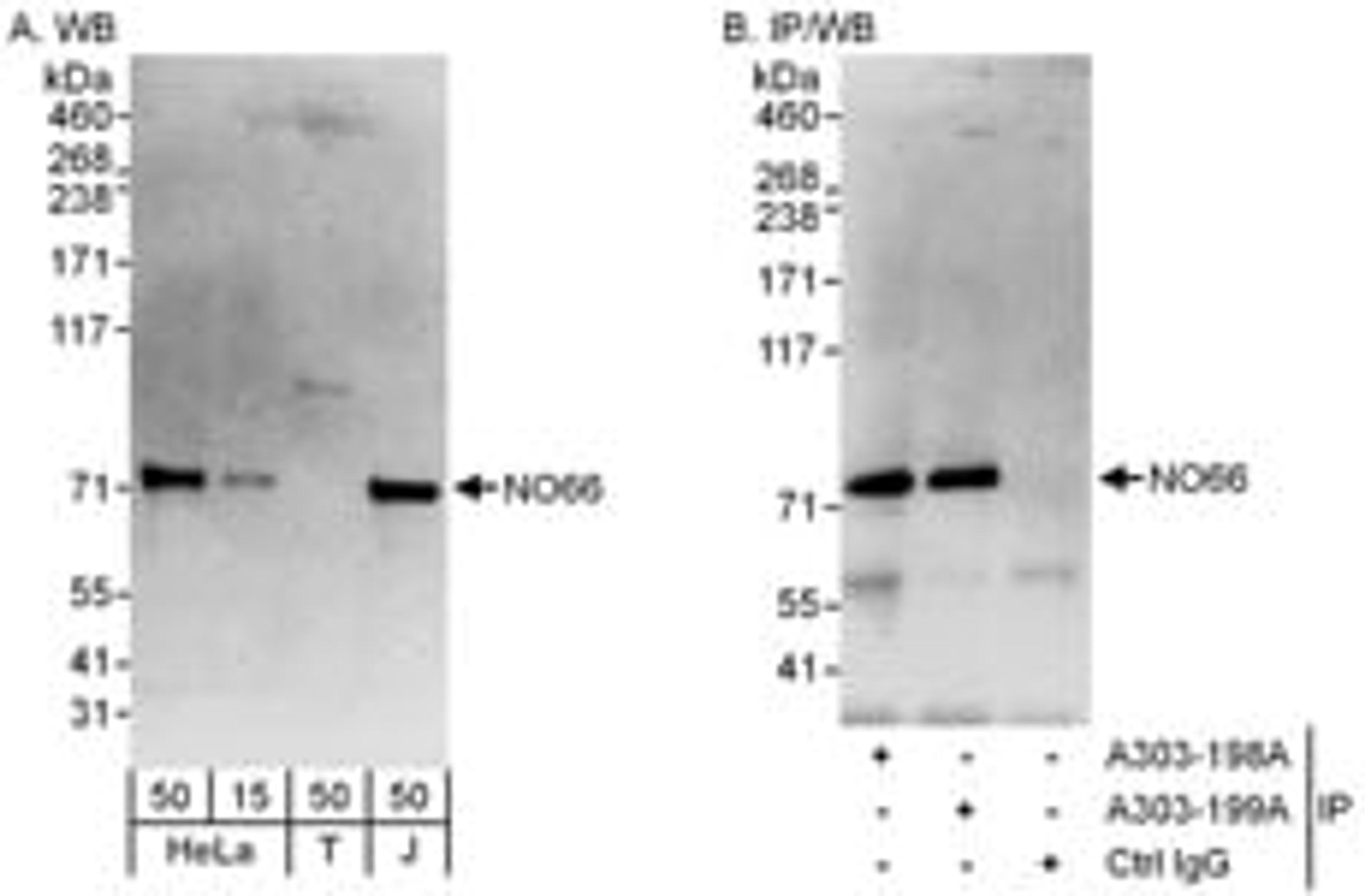 Detection of human NO66 by western blot and immunoprecipitation.