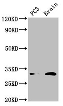 Western Blot. Positive WB detected in: PC-3 whole cell lysate, Mouse brain tissue. All lanes: HOXD8 antibody at 4.5µg/ml. Secondary. Goat polyclonal to rabbit IgG at 1/50000 dilution. Predicted band size: 32, 9 kDa. Observed band size: 32 kDa