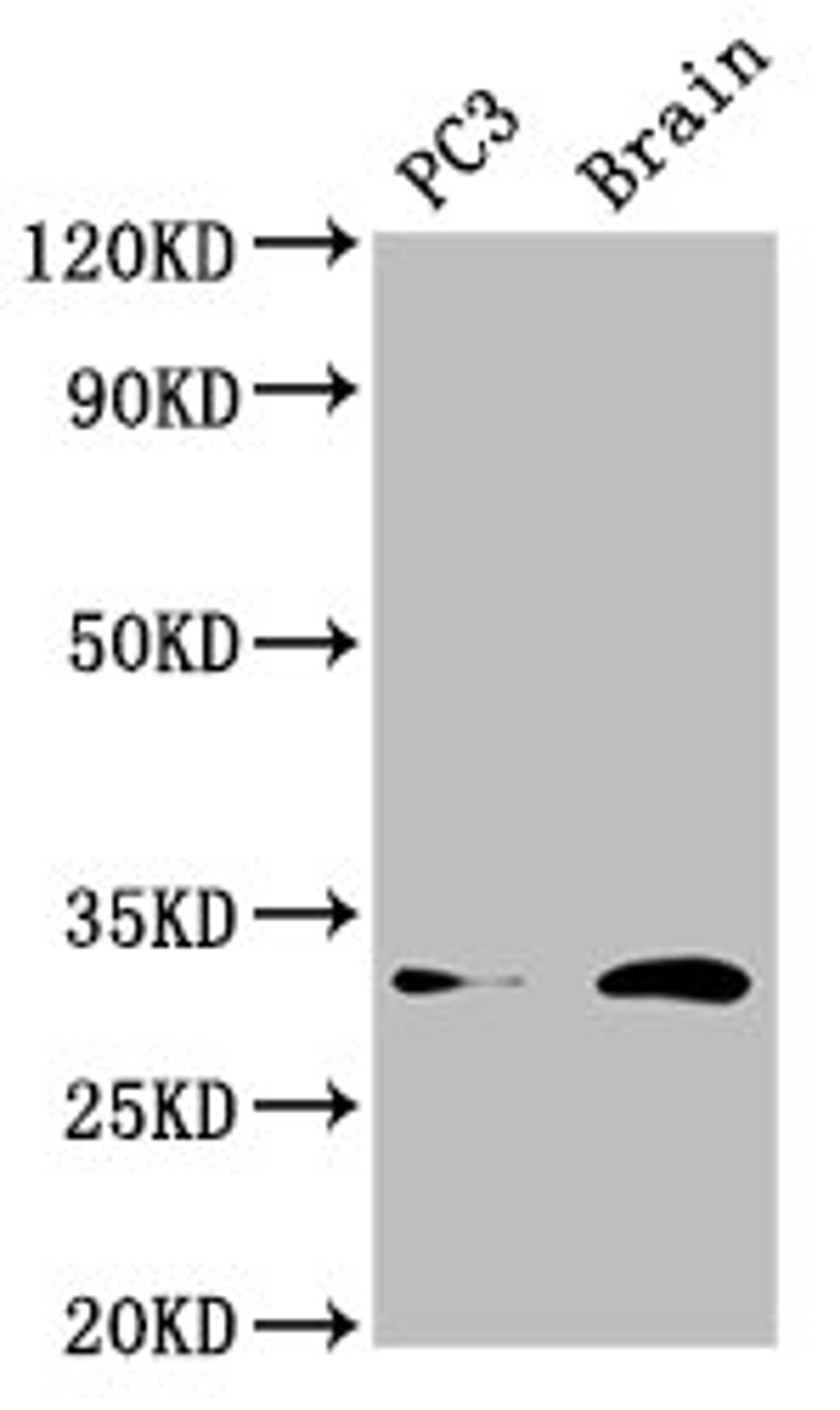 Western Blot. Positive WB detected in: PC-3 whole cell lysate, Mouse brain tissue. All lanes: HOXD8 antibody at 4.5µg/ml. Secondary. Goat polyclonal to rabbit IgG at 1/50000 dilution. Predicted band size: 32, 9 kDa. Observed band size: 32 kDa