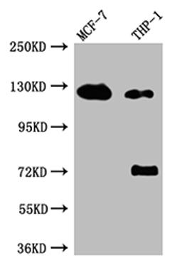 Western Blot. Positive WB detected in: MCF-7 whole cell lysate, THP-1 whole cell lysate. All lanes: Androgen Receptor antibody at 1:1000. Secondary. Goat polyclonal to rabbit IgG at 1/50000 dilution. Predicted band size: 100, 45, 68, kDa. Observed band size: 125 kDa.