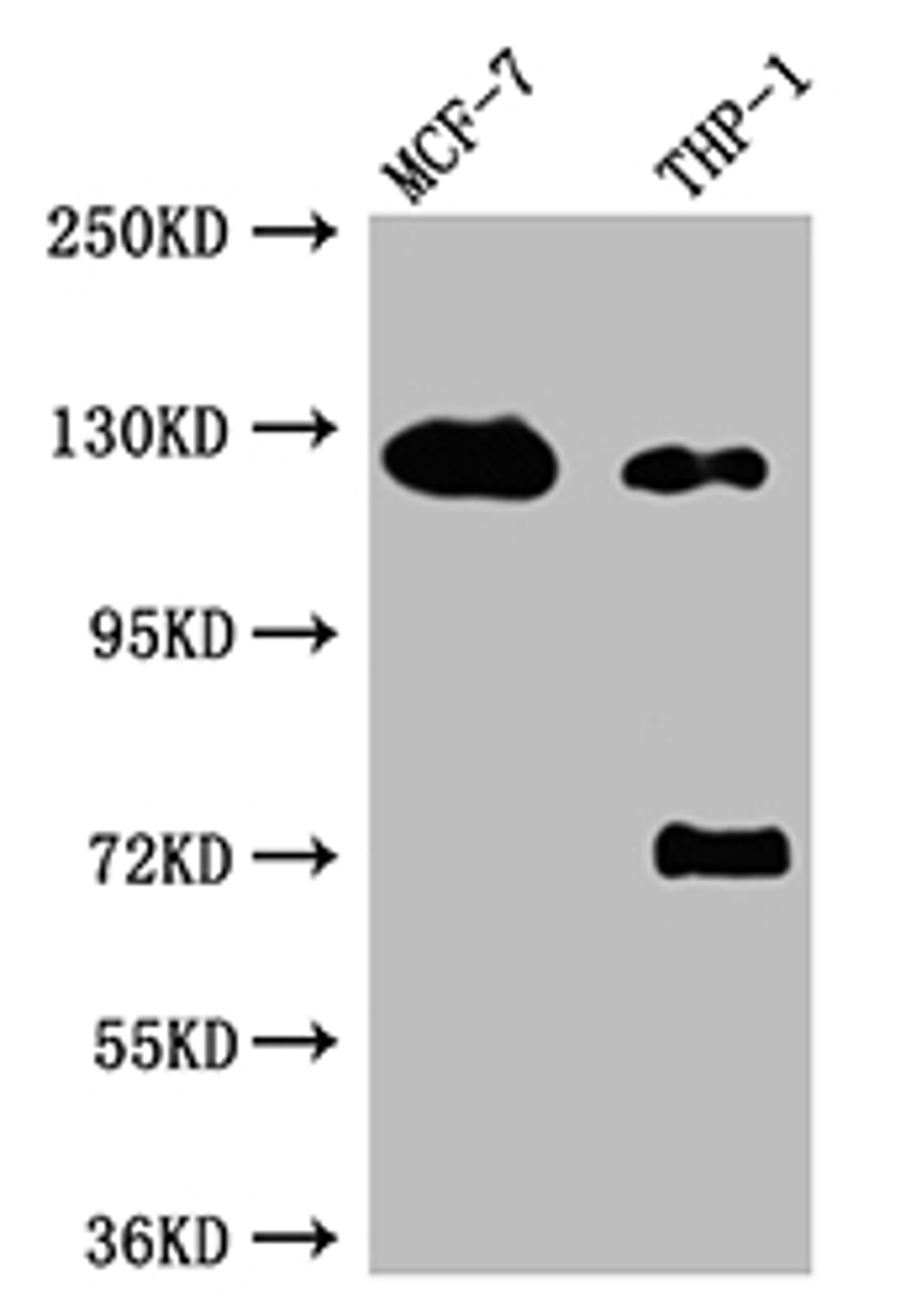 Western Blot. Positive WB detected in: MCF-7 whole cell lysate, THP-1 whole cell lysate. All lanes: Androgen Receptor antibody at 1:1000. Secondary. Goat polyclonal to rabbit IgG at 1/50000 dilution. Predicted band size: 100, 45, 68, kDa. Observed band size: 125 kDa.