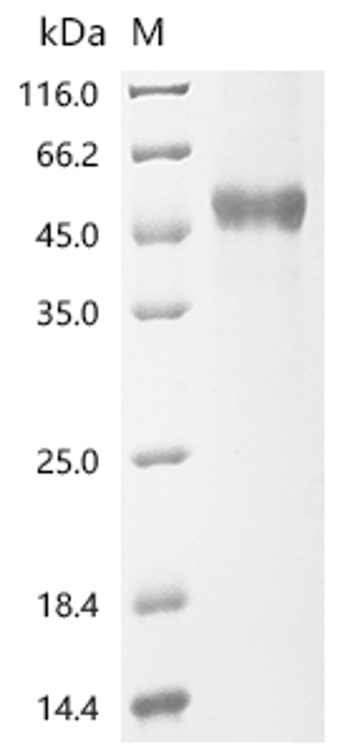 (Tris-Glycine gel) Discontinuous SDS-PAGE (reduced) with 5% enrichment gel and 15% separation gel.
