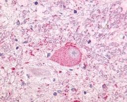 Immunohistochemistry-Paraffin: Neurotensin Receptor 1 Antibody [NLS938] - Analysis of anti-NTSR1 / NTR antibody with brain, neurons and glia at 16 ug/ ml.