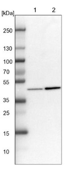 Western Blot: KAT1 Antibody [NBP1-87835] - Lane 1: NIH-3T3 cell lysate (Mouse embryonic fibroblast cells)<br/>Lane 2: NBT-II cell lysate (Rat Wistar bladder tumour cells)