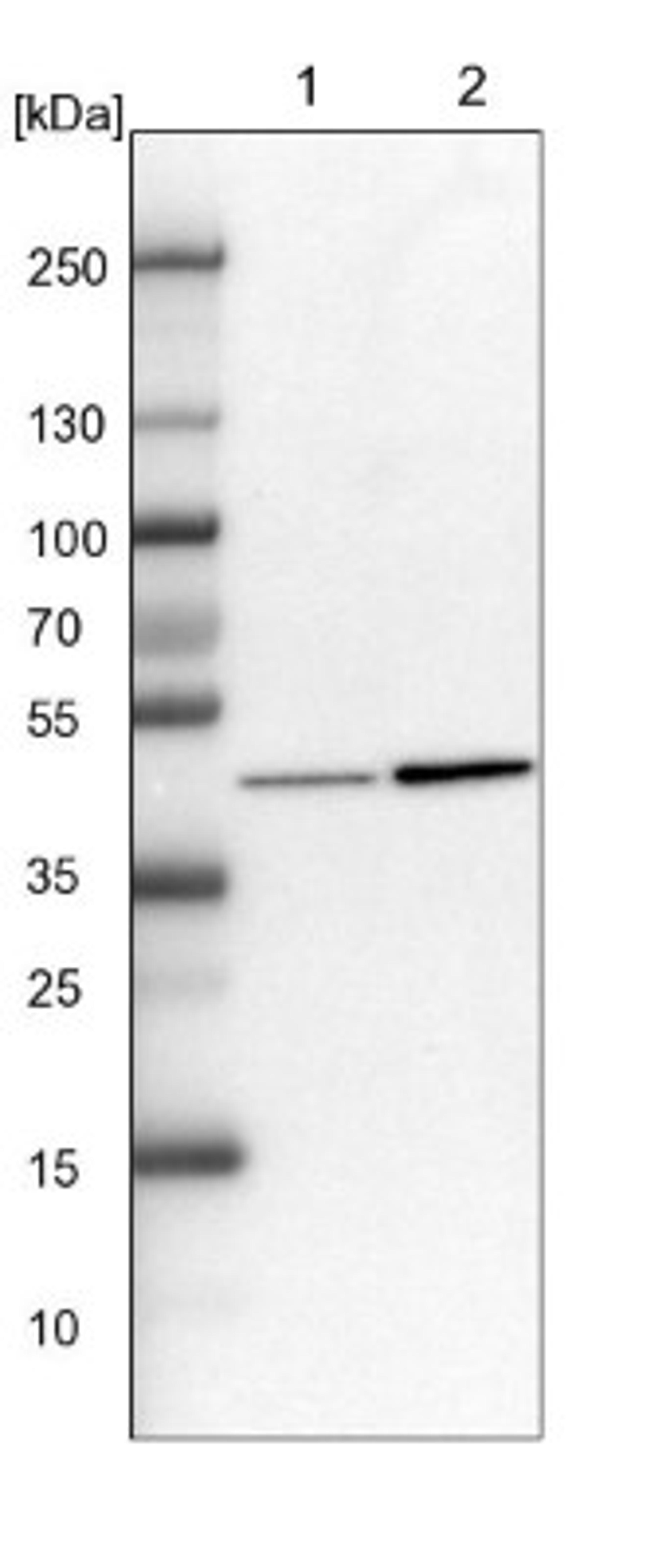 Western Blot: KAT1 Antibody [NBP1-87835] - Lane 1: NIH-3T3 cell lysate (Mouse embryonic fibroblast cells)<br/>Lane 2: NBT-II cell lysate (Rat Wistar bladder tumour cells)