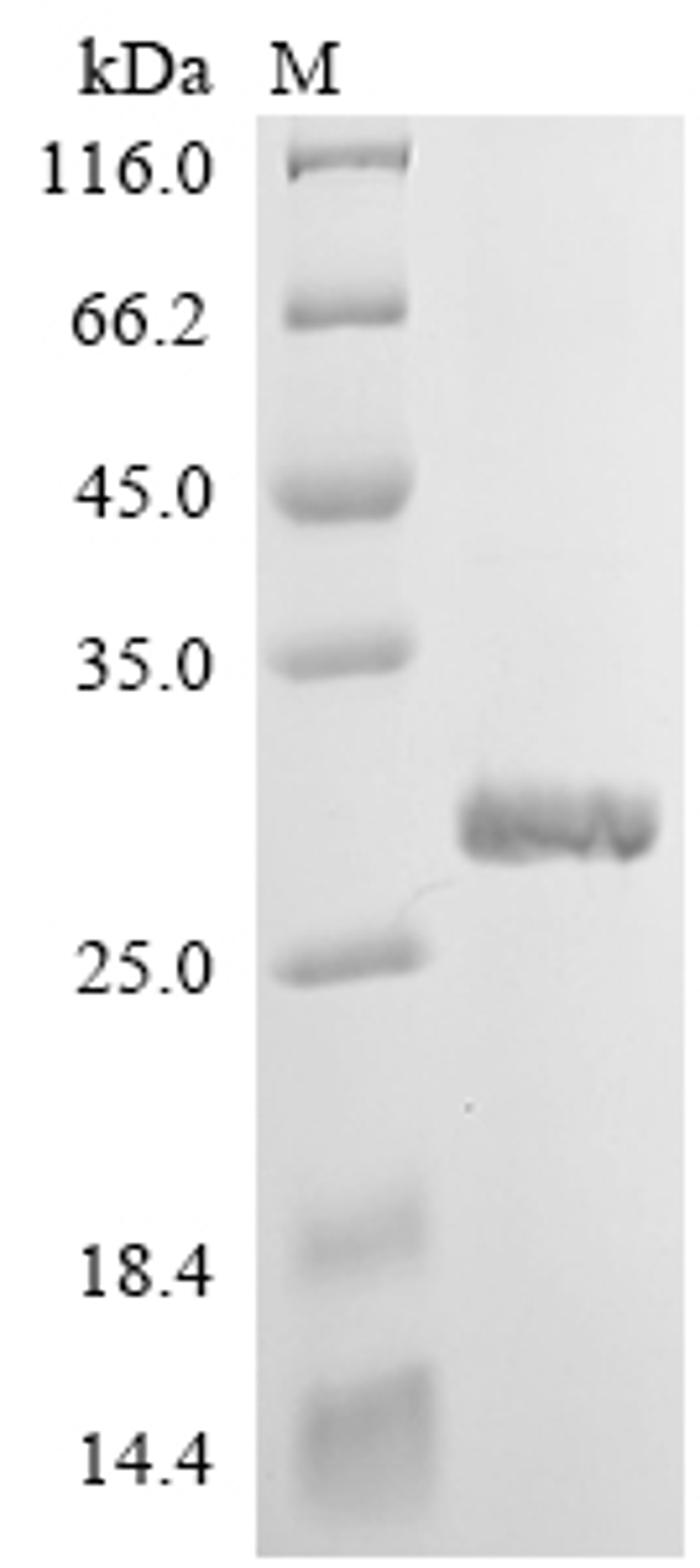 (Tris-Glycine gel) Discontinuous SDS-PAGE (reduced) with 5% enrichment gel and 15% separation gel.