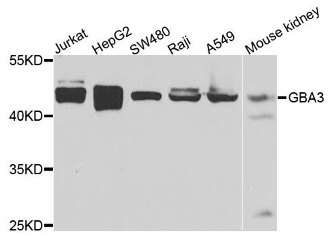 Western blot analysis of extracts of various cells using GBA3 antibody