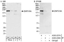 Detection of human ZNF518A by western blot and immunoprecipitation.