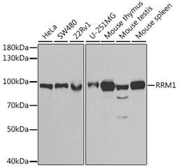 Western blot - RRM1 antibody (A13348)