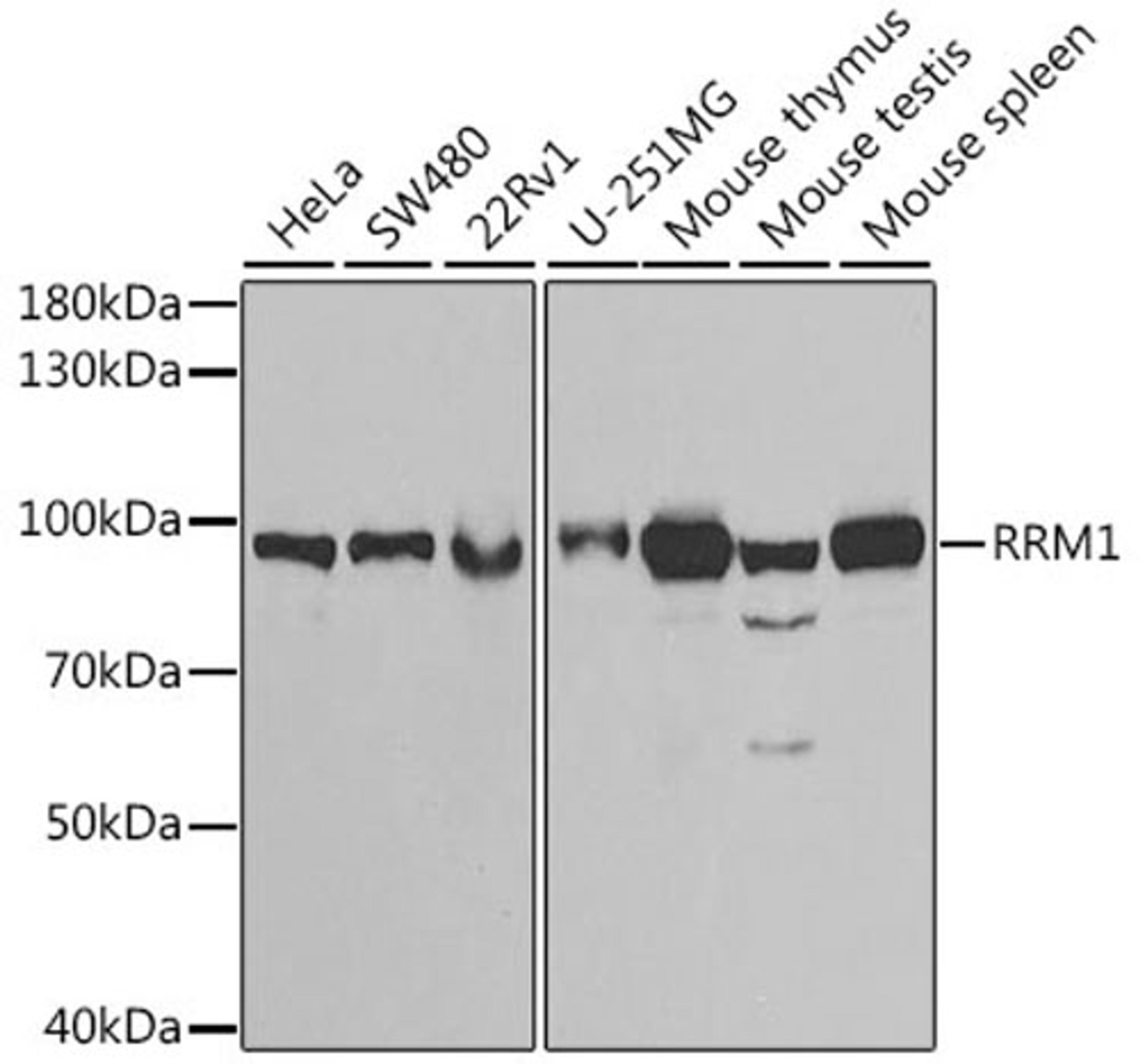 Western blot - RRM1 antibody (A13348)