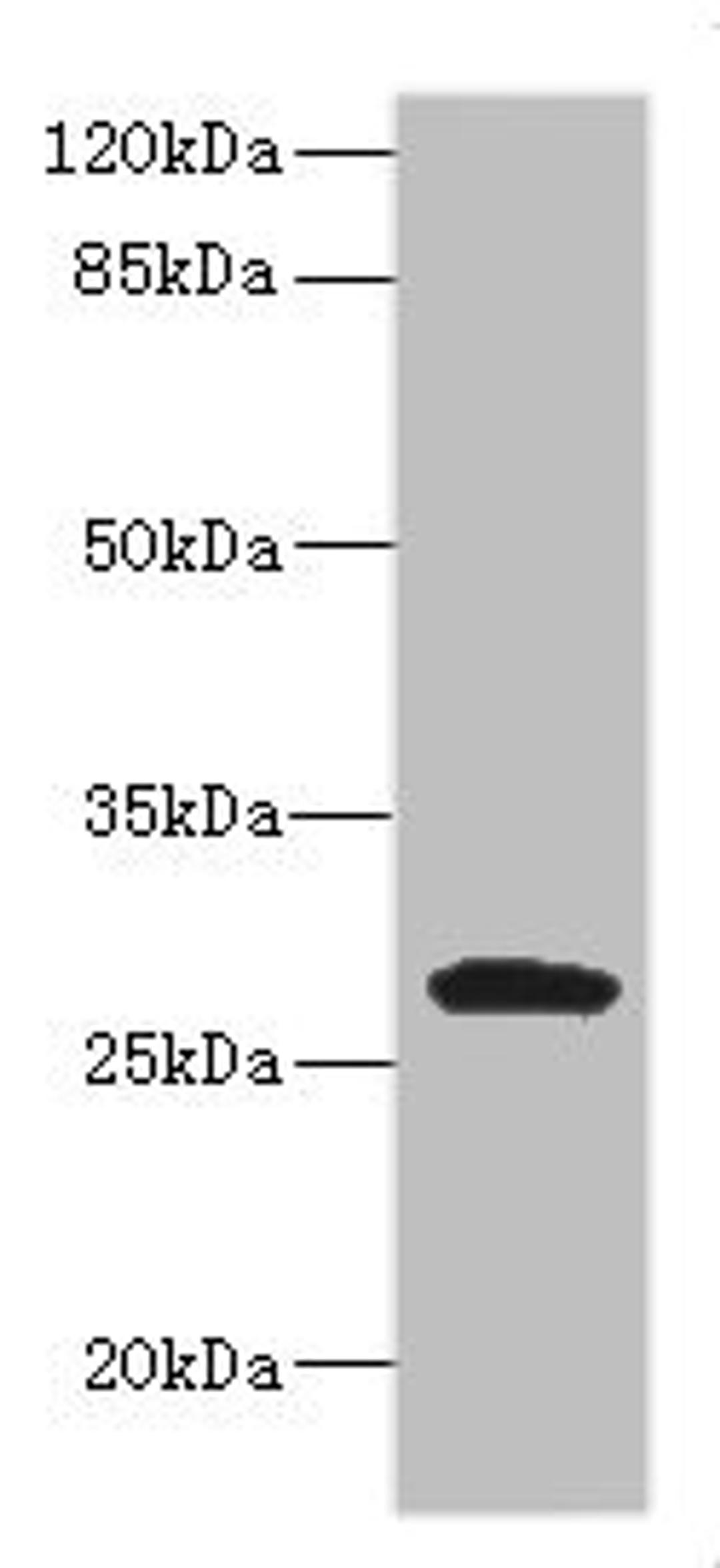 Western BlotPositive WB detected in: MCF7 whole cell lysate, JK whole cell lysate, Raji whole cell lysate, THP-1 whole cell lysate, K562 whole cell lysate,U937 whole cell lysate,Mouse Kidney tissue lysateAll lanes: CLEC9A antibody at 1:1000SecondaryGoat polyclonal to rabbit IgG at 1/40000 dilutionPredicted band size: 27 kDaObserved band size: 35 kDa