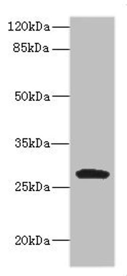 Western BlotPositive WB detected in: MCF7 whole cell lysate, JK whole cell lysate, Raji whole cell lysate, THP-1 whole cell lysate, K562 whole cell lysate,U937 whole cell lysate,Mouse Kidney tissue lysateAll lanes: CLEC9A antibody at 1:1000SecondaryGoat polyclonal to rabbit IgG at 1/40000 dilutionPredicted band size: 27 kDaObserved band size: 35 kDa