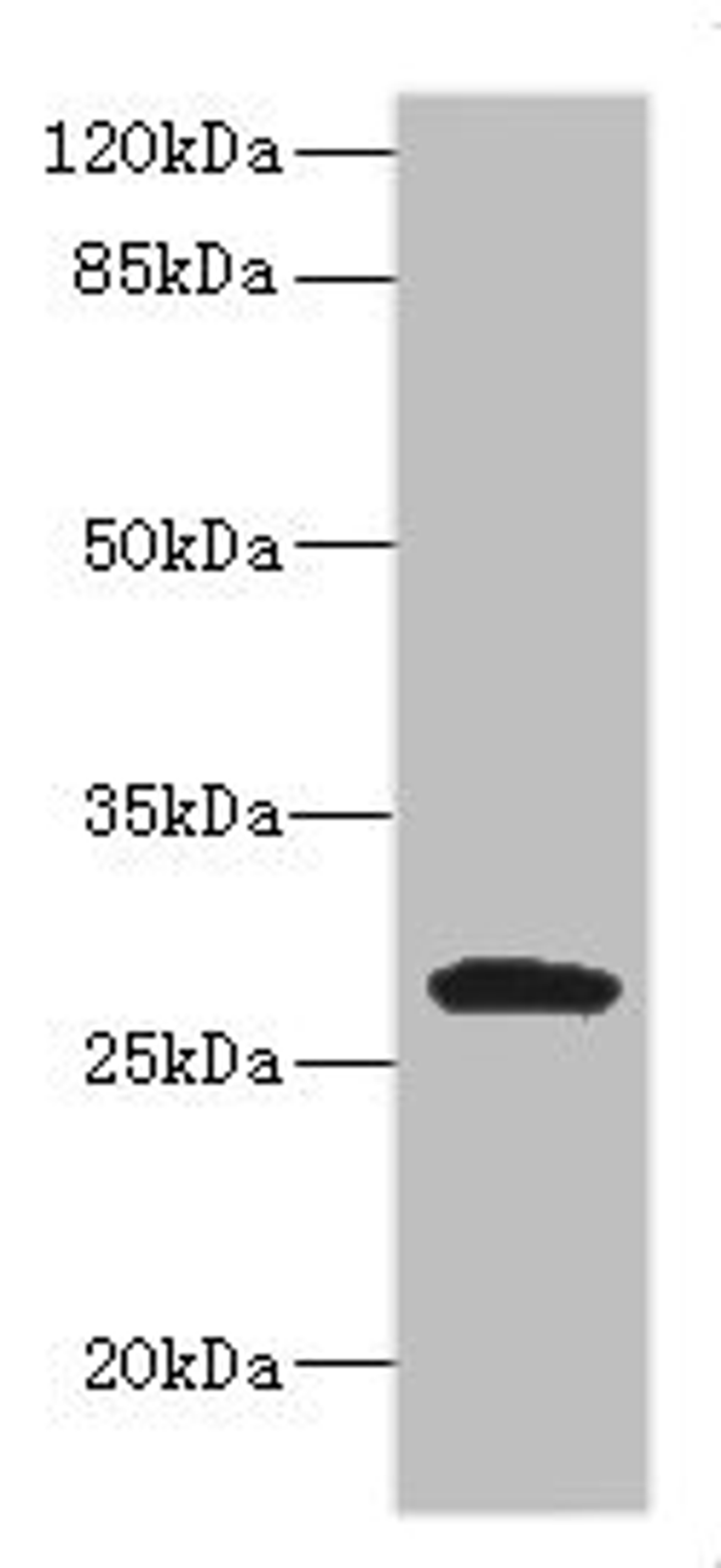 Western BlotPositive WB detected in: MCF7 whole cell lysate, JK whole cell lysate, Raji whole cell lysate, THP-1 whole cell lysate, K562 whole cell lysate,U937 whole cell lysate,Mouse Kidney tissue lysateAll lanes: CLEC9A antibody at 1:1000SecondaryGoat polyclonal to rabbit IgG at 1/40000 dilutionPredicted band size: 27 kDaObserved band size: 35 kDa