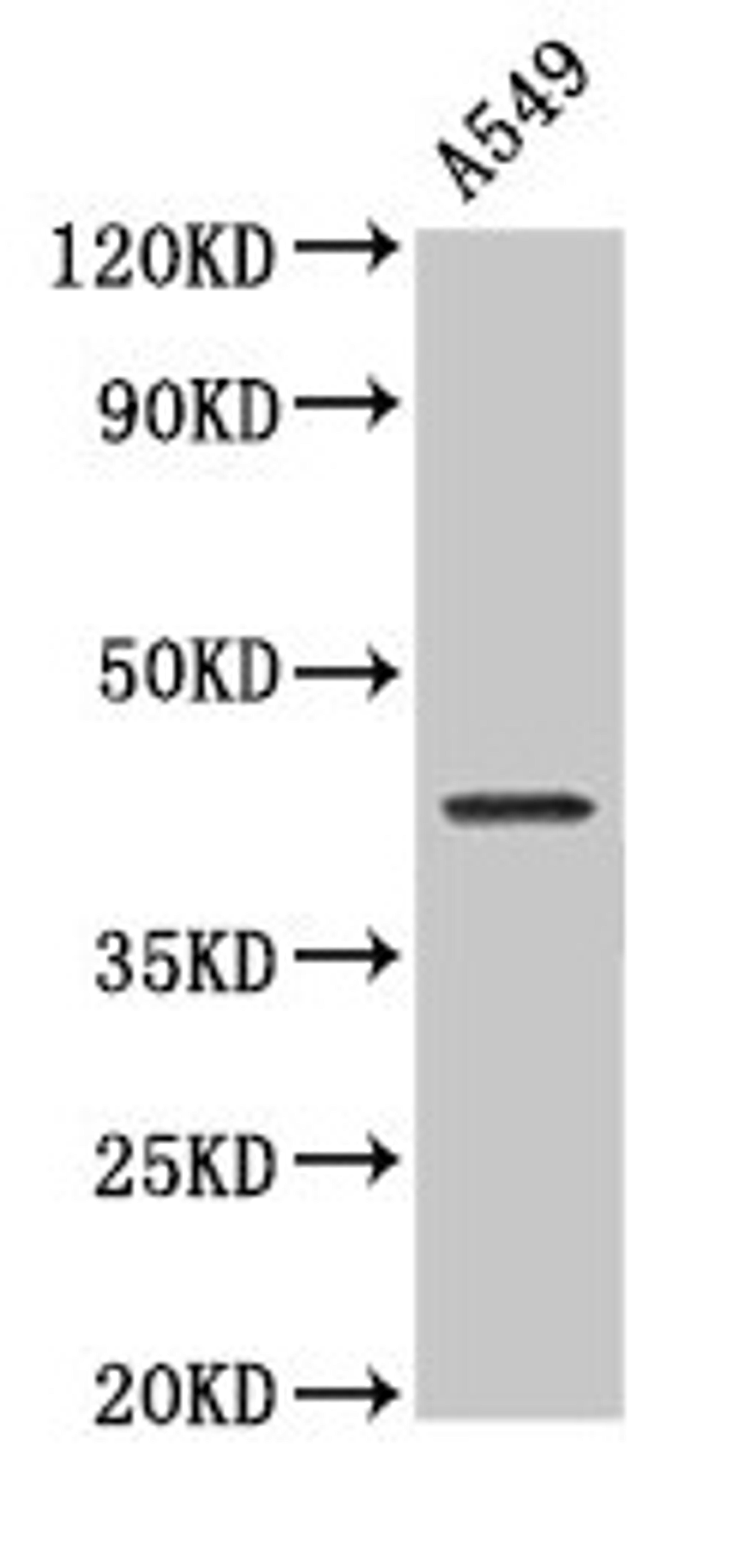 Western Blot. Positive WB detected in: A549 whole cell lysate. All lanes: NDRG4 antibody at 2µg/ml. Secondary. Goat polyclonal to rabbit IgG at 1/50000 dilution. Predicted band size: 39, 38, 41, 43, 40 kDa. Observed band size: 43 kDa
