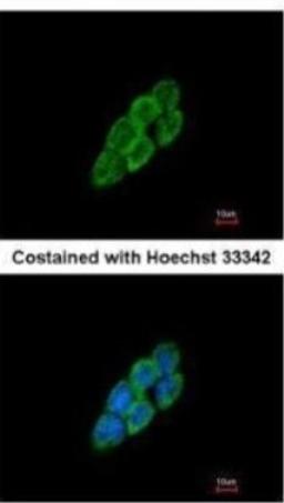 Immunocytochemistry/Immunofluorescence: Latent TGF-beta bp4 Antibody [NBP2-43671] - Analysis of methanol-fixed A431, using LTBP4 antibody at 1:200 dilution.