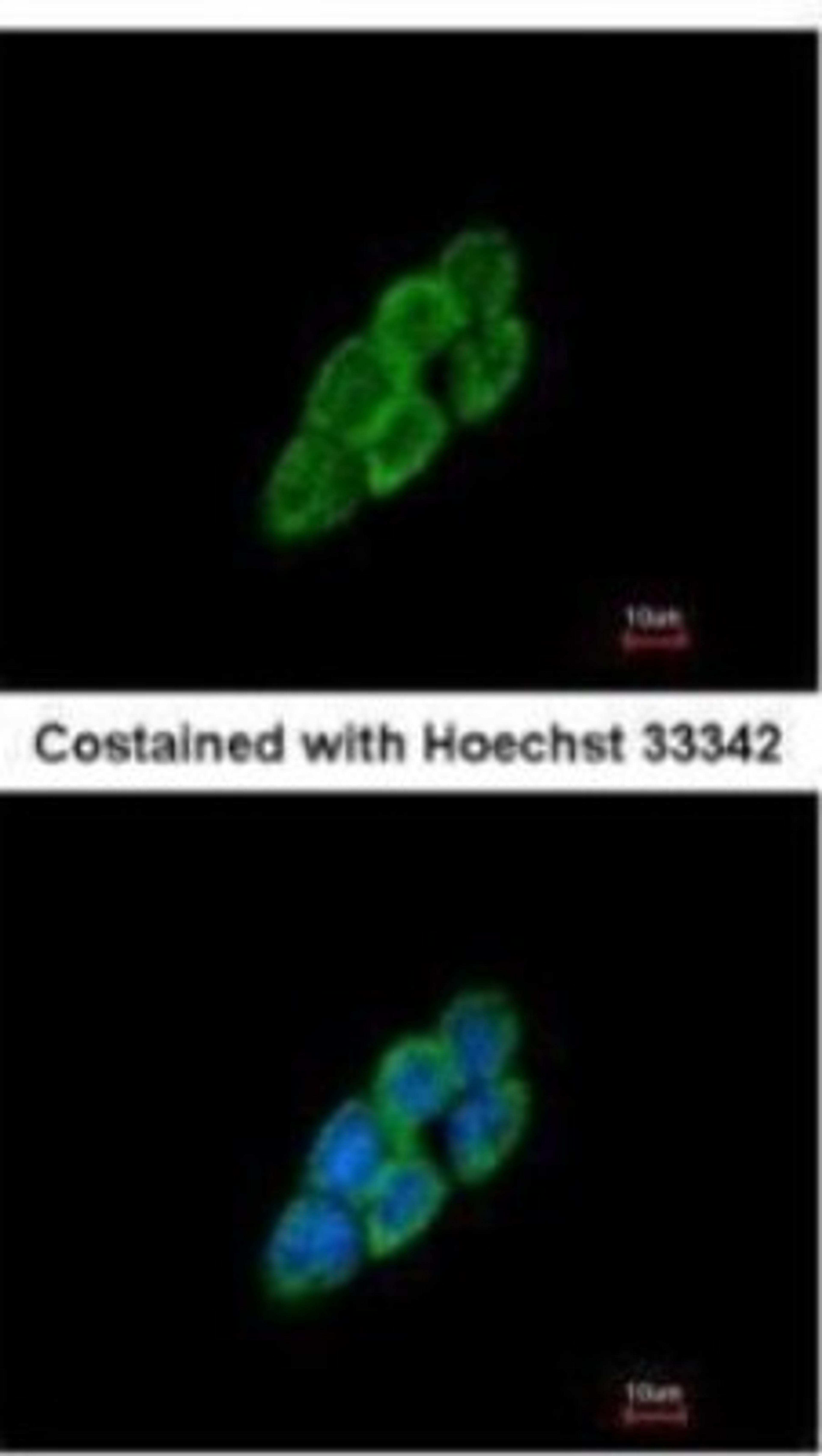 Immunocytochemistry/Immunofluorescence: Latent TGF-beta bp4 Antibody [NBP2-43671] - Analysis of methanol-fixed A431, using LTBP4 antibody at 1:200 dilution.