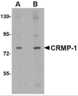 Western blot analysis of CRMP1 in rat brain tissue lysate with CRMP1 antibody at (A) 1 and (B) 2 &#956;g/mL.