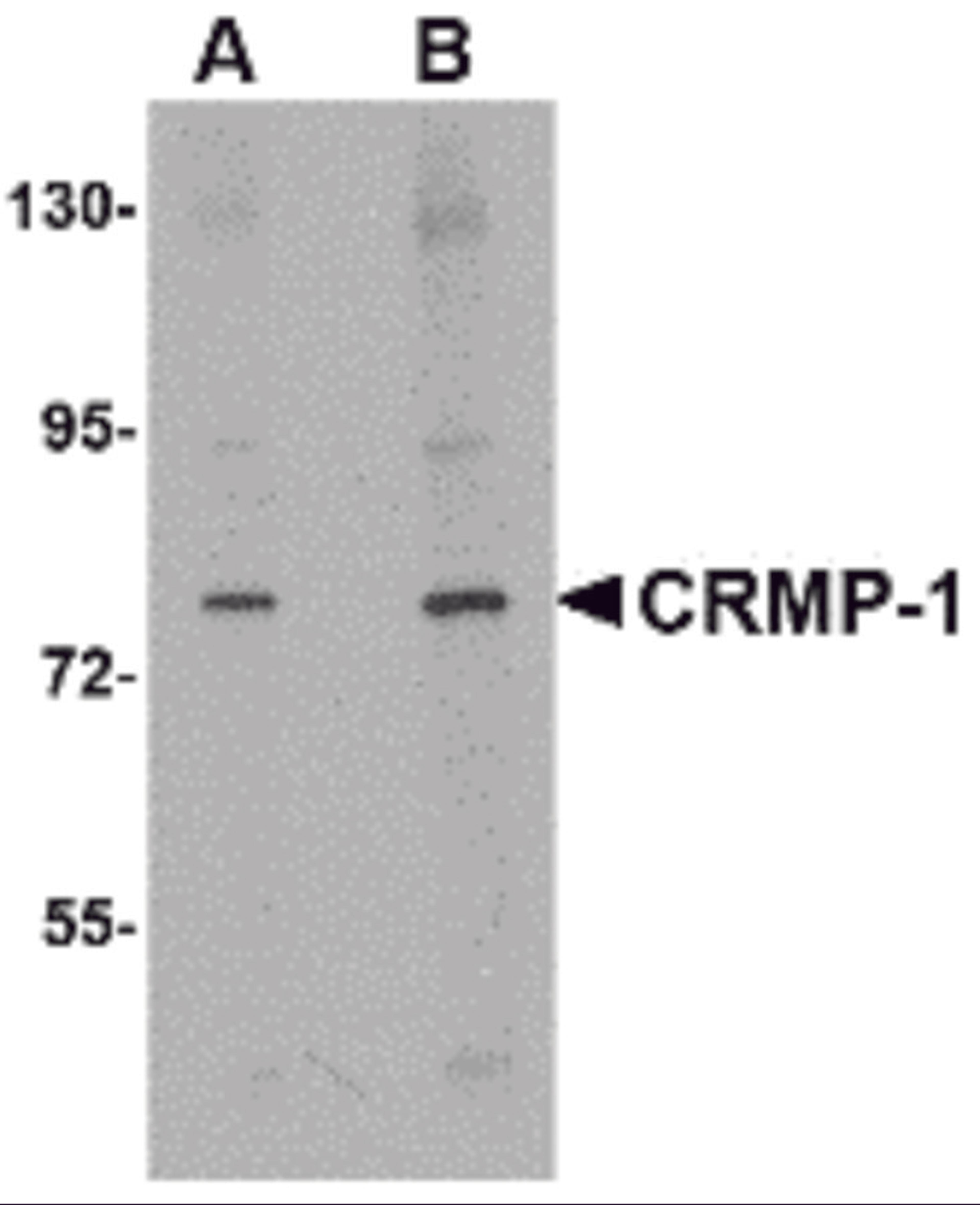 Western blot analysis of CRMP1 in rat brain tissue lysate with CRMP1 antibody at (A) 1 and (B) 2 &#956;g/mL.