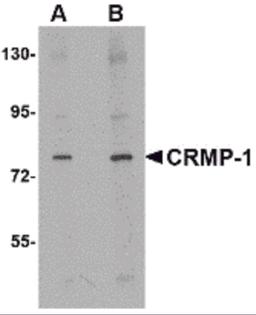 Western blot analysis of CRMP1 in rat brain tissue lysate with CRMP1 antibody at (A) 1 and (B) 2 μg/mL.