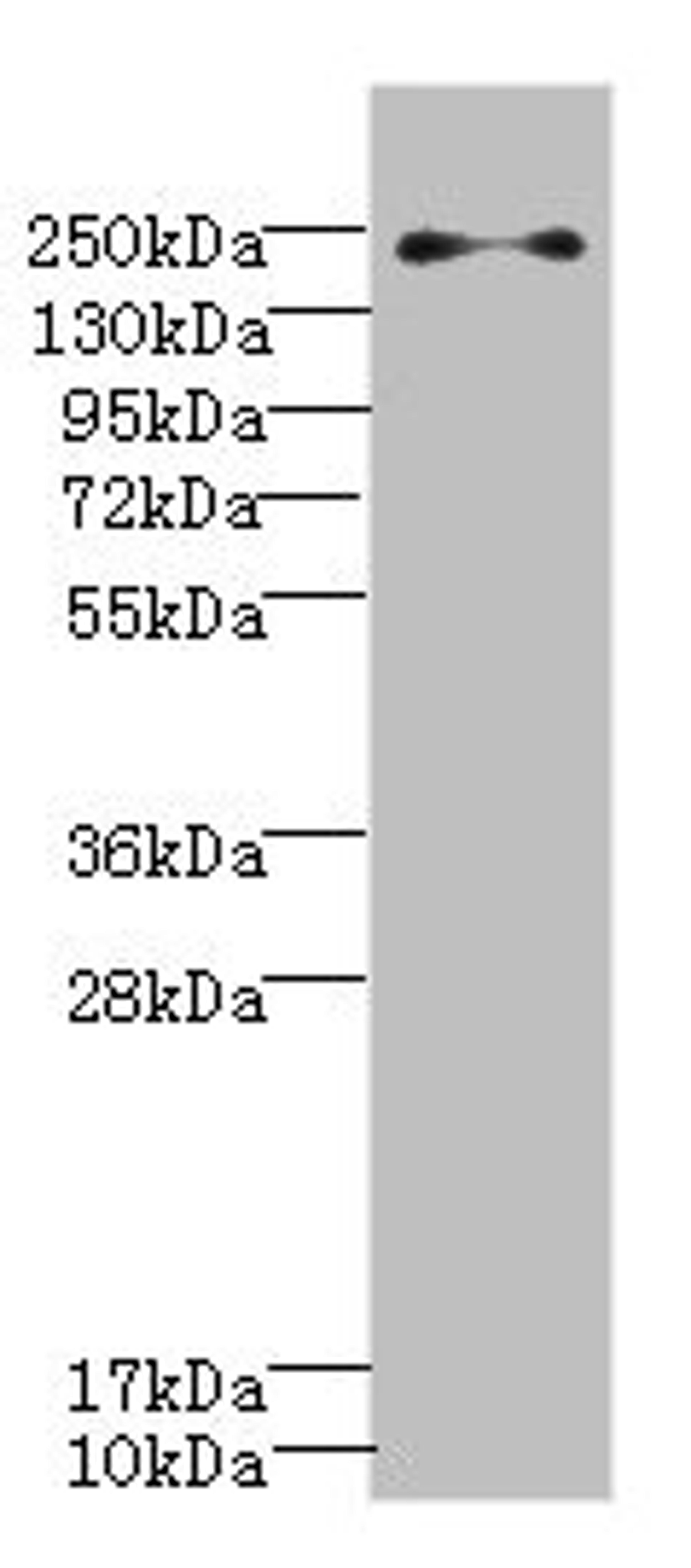 Western blot. All lanes: PLA2R1 antibody IgG at 0.78ug/ml + Jurkat whole cell lysate. Secondary. Goat polyclonal to rabbit IgG at 1/10000 dilution. Predicted band size: 169, 153 kDa. Observed band size: 169 kDa.