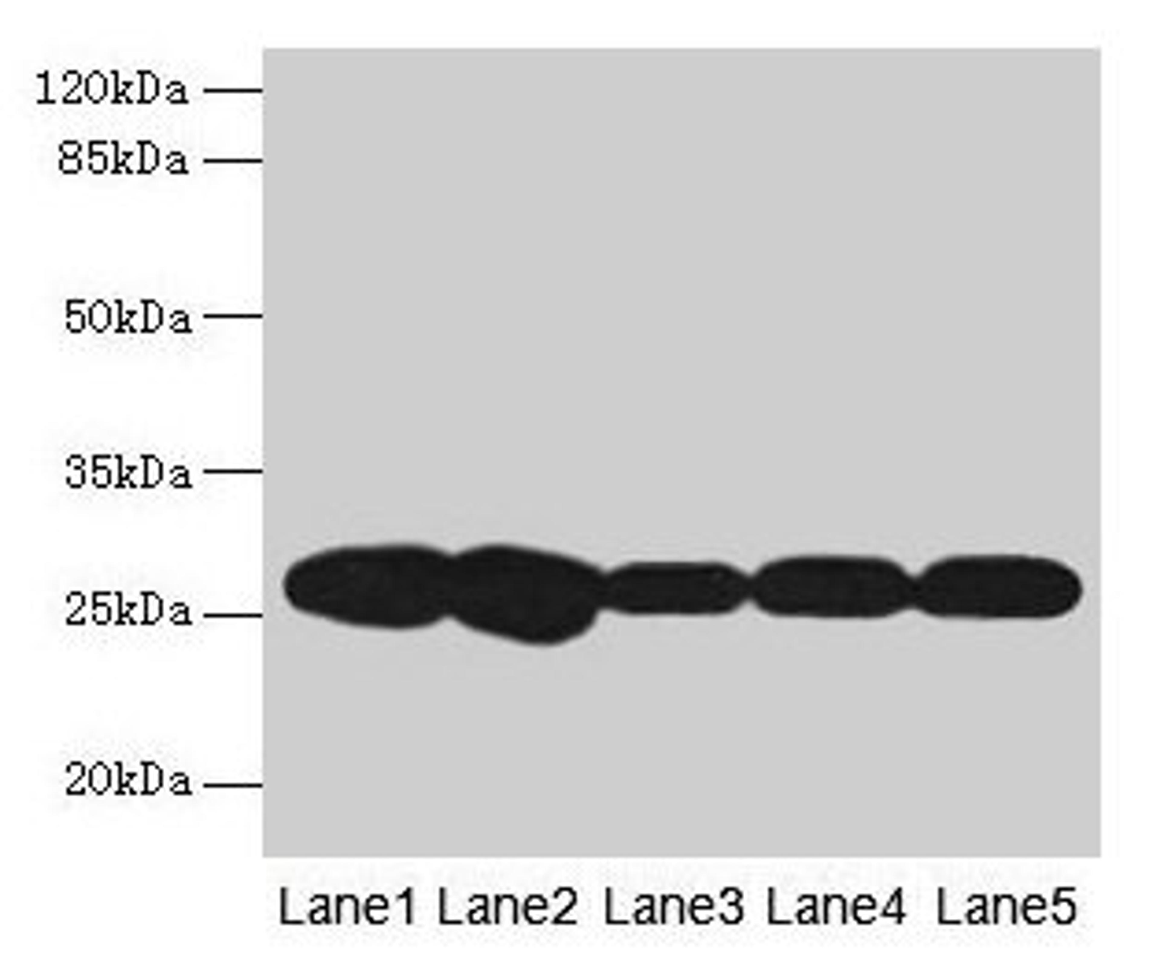 Western blot. All lanes: FKBP3 antibody at 4µg/ml. Lane 1: Hela whole cell lysate. Lane 2: A431 whole cell lysate. Lane 3: PC-3 whole cell lysate. Lane 4: Jurkat whole cell lysate. Lane 5: 293T whole cell lysate. Secondary. Goat polyclonal to rabbit IgG at 1/10000 dilution. Predicted band size: 26 kDa. Observed band size: 26 kDa