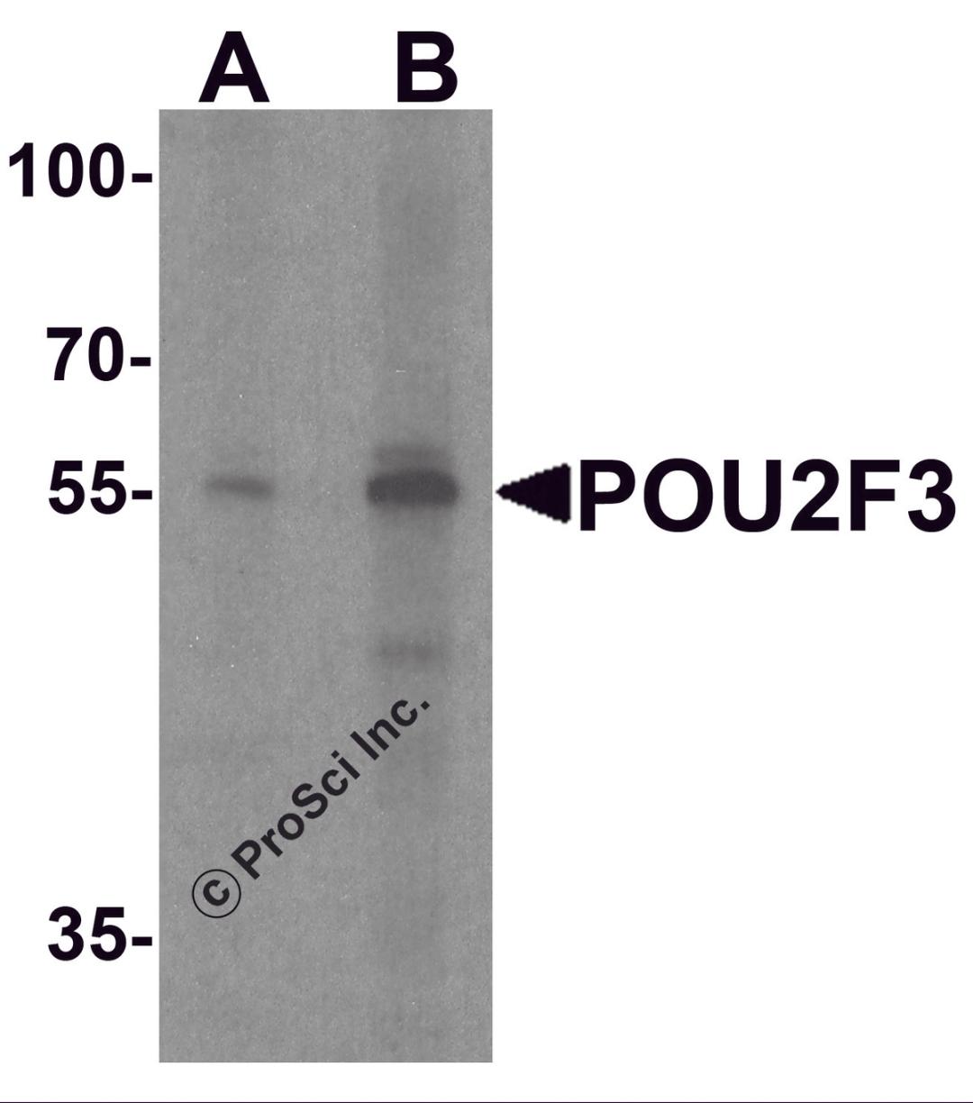 Western blot analysis of POU2F3 in SK-N-SH cell lysate with POU2F3 antibody at (A) 1 and (B) 2 &#956;g/ml.