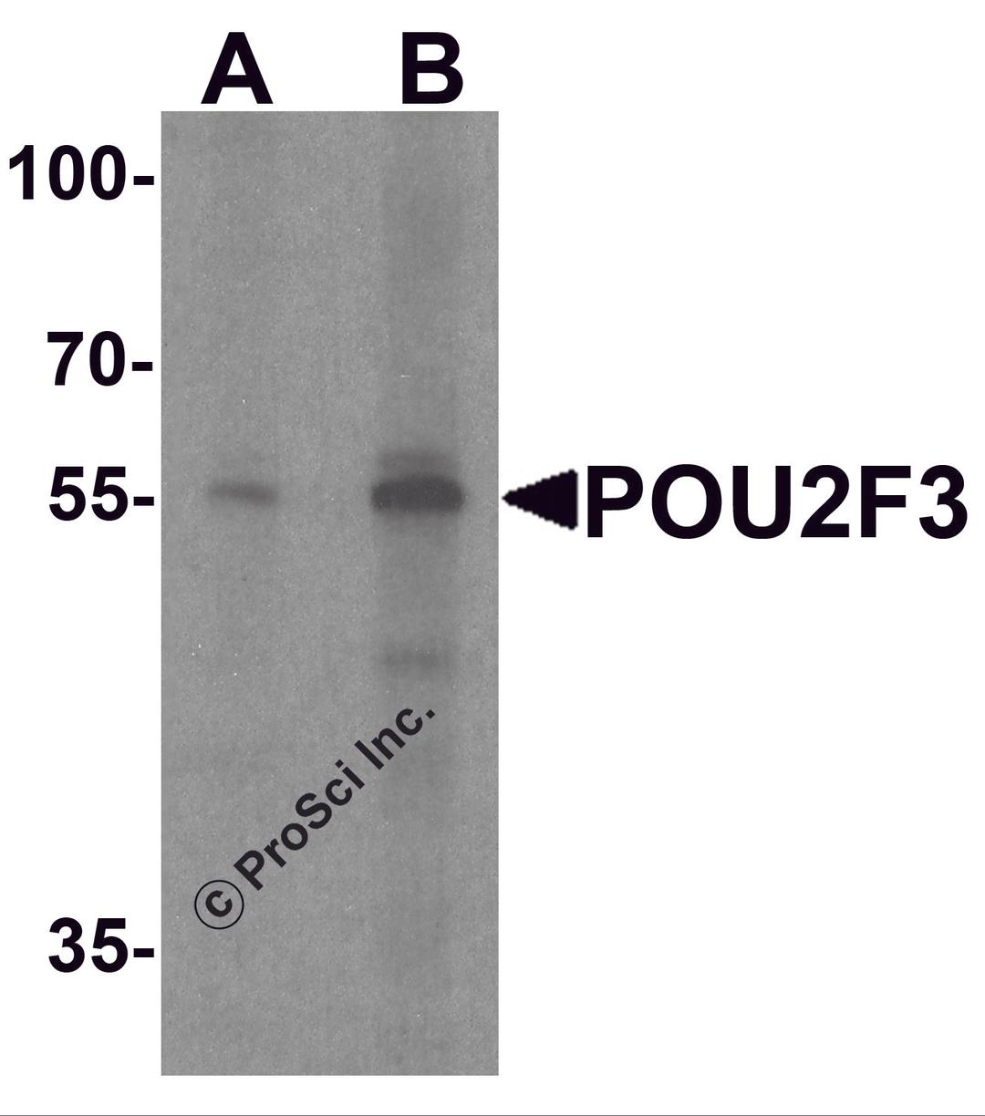 Western blot analysis of POU2F3 in SK-N-SH cell lysate with POU2F3 antibody at (A) 1 and (B) 2 μg/ml.