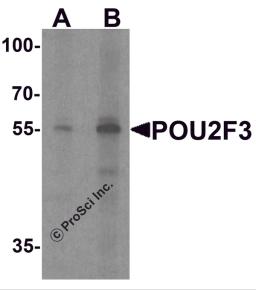 Western blot analysis of POU2F3 in SK-N-SH cell lysate with POU2F3 antibody at (A) 1 and (B) 2 μg/ml.