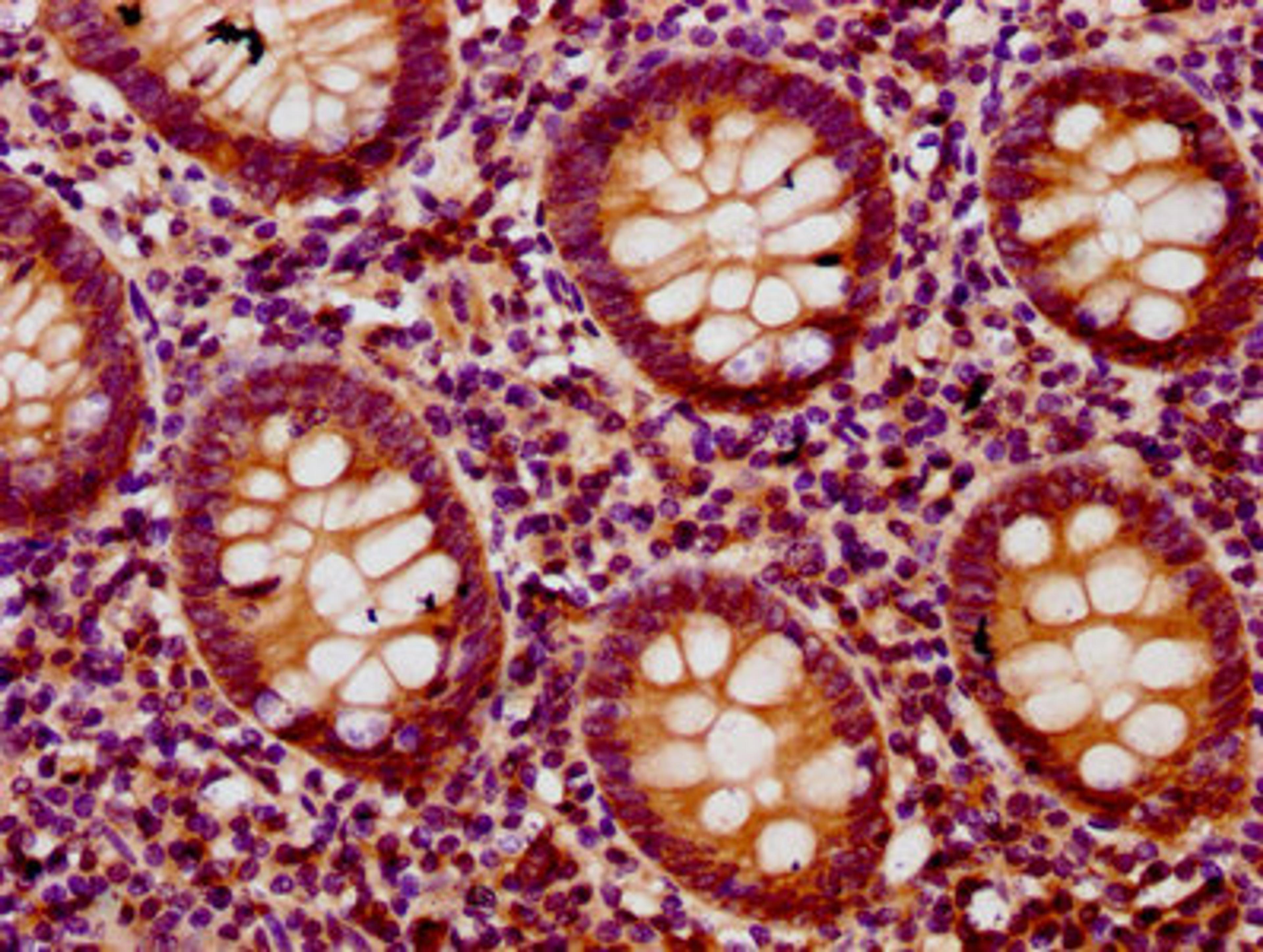 IHC image of CSB-PA883639LA01HU diluted at 1:200 and staining in paraffin-embedded human appendix tissue performed on a Leica BondTM system. After dewaxing and hydration, antigen retrieval was mediated by high pressure in a citrate buffer (pH 6.0). Section was blocked with 10% normal goat serum 30min at RT. Then primary antibody (1% BSA) was incubated at 4&deg;C overnight. The primary is detected by a biotinylated secondary antibody and visualized using an HRP conjugated SP system.