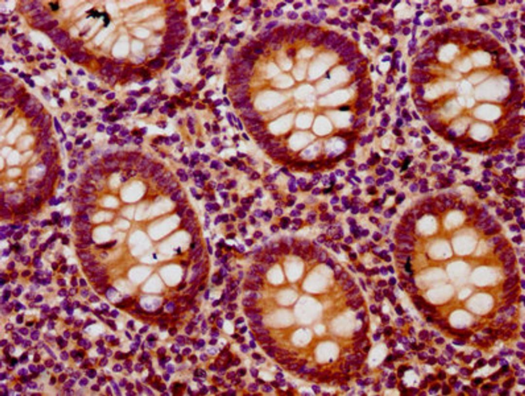 IHC image of CSB-PA883639LA01HU diluted at 1:200 and staining in paraffin-embedded human appendix tissue performed on a Leica BondTM system. After dewaxing and hydration, antigen retrieval was mediated by high pressure in a citrate buffer (pH 6.0). Section was blocked with 10% normal goat serum 30min at RT. Then primary antibody (1% BSA) was incubated at 4°C overnight. The primary is detected by a biotinylated secondary antibody and visualized using an HRP conjugated SP system.