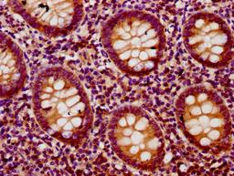 IHC image of CSB-PA883639LA01HU diluted at 1:200 and staining in paraffin-embedded human appendix tissue performed on a Leica BondTM system. After dewaxing and hydration, antigen retrieval was mediated by high pressure in a citrate buffer (pH 6.0). Section was blocked with 10% normal goat serum 30min at RT. Then primary antibody (1% BSA) was incubated at 4°C overnight. The primary is detected by a biotinylated secondary antibody and visualized using an HRP conjugated SP system.