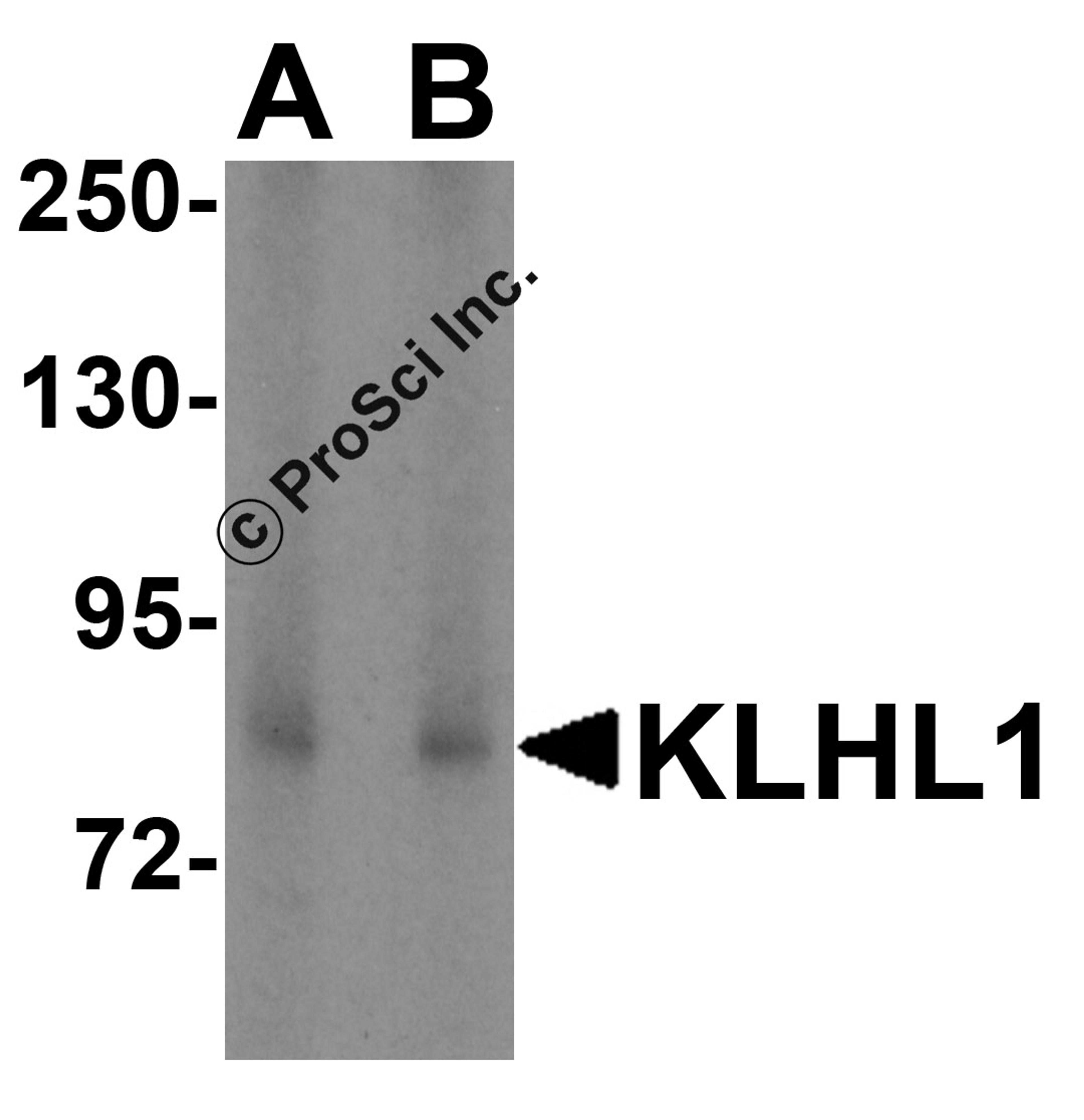 Western blot analysis of KLHL1 in HeLa cell lysate with KLHL1 antibody at (A) 2 and (B) 4 μg/mL.